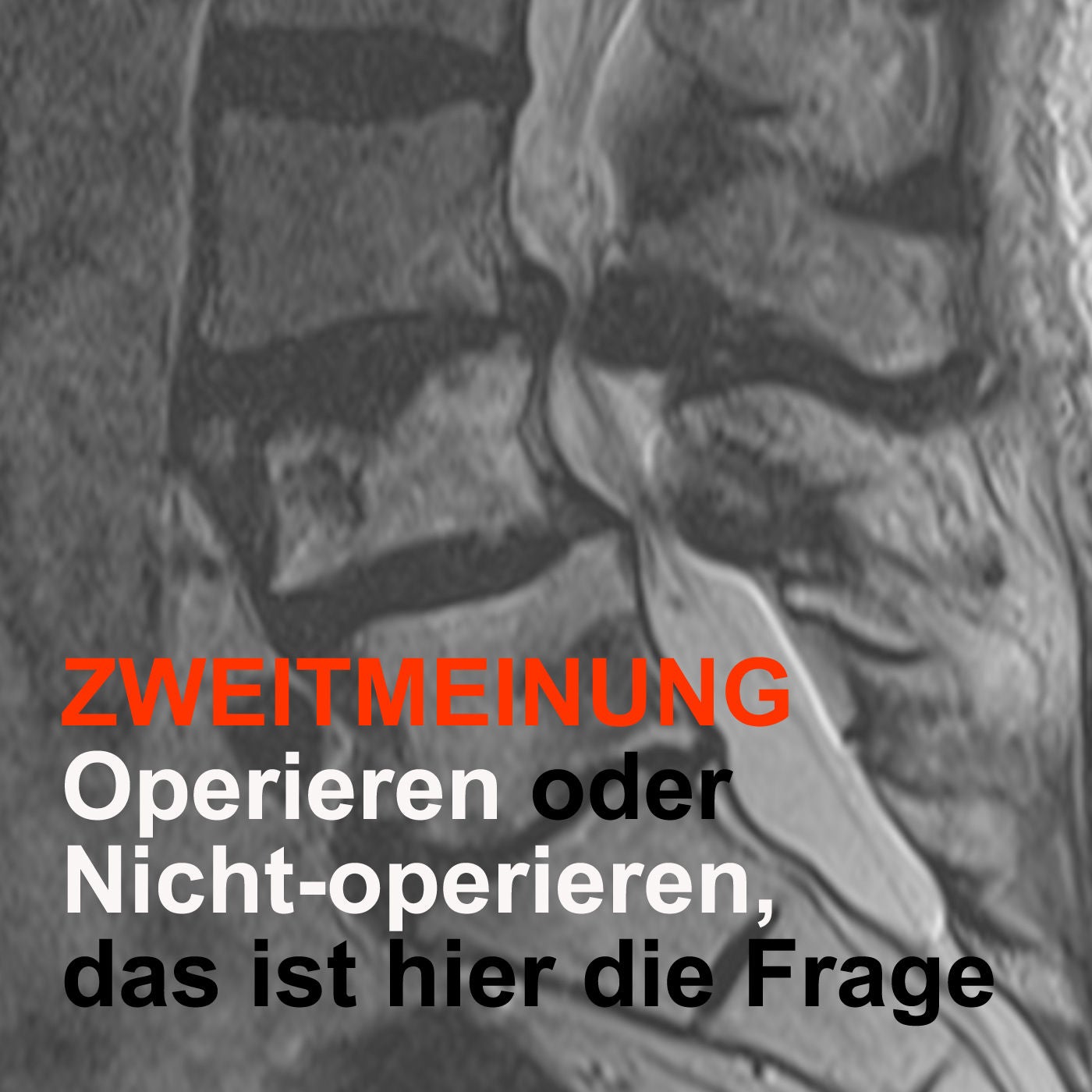 ZWEITMEINUNG - Operieren oder Nicht-operieren, das ist hier die Frage
