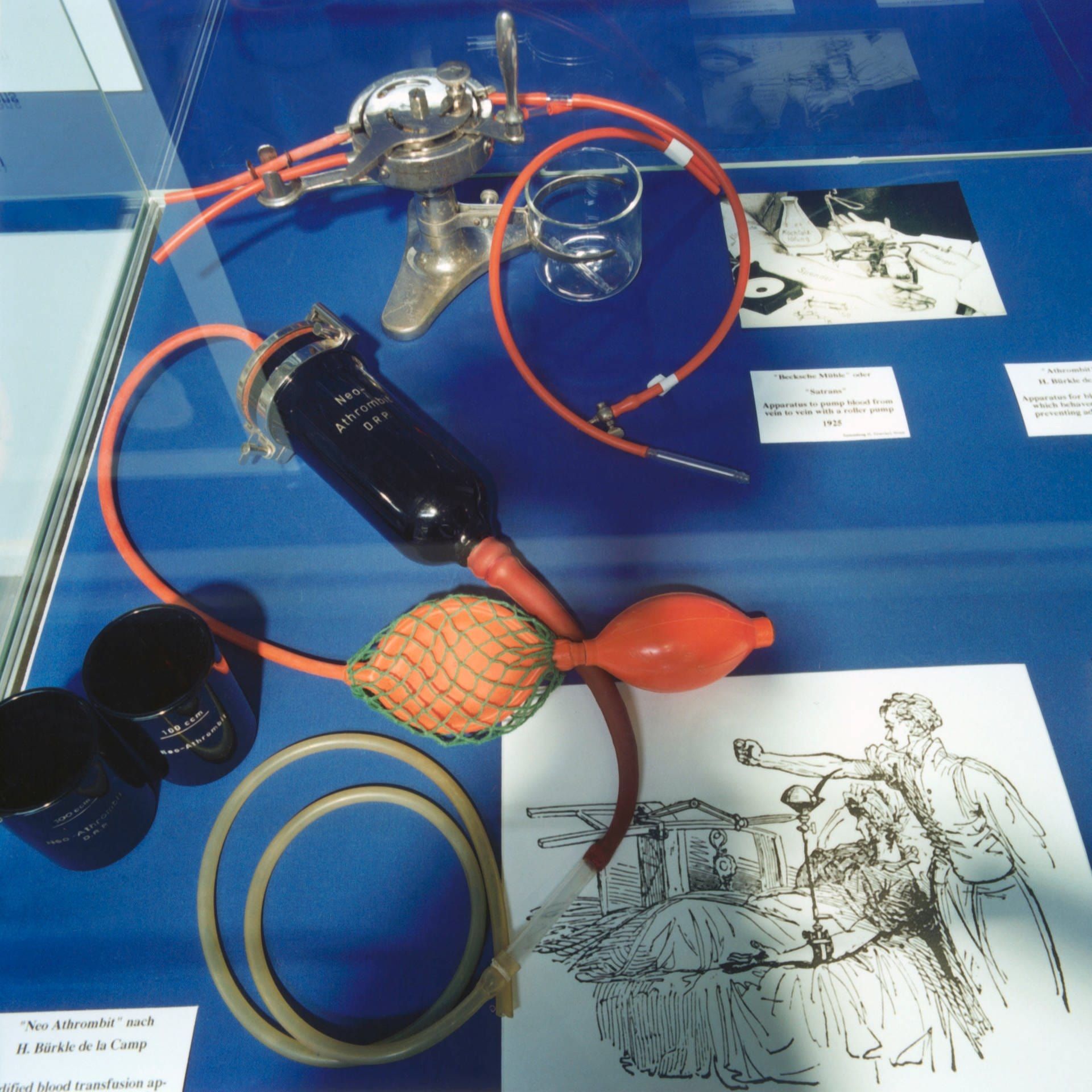 Franz Oehlecker über die moderne Bluttransfusion | 5.1.1932