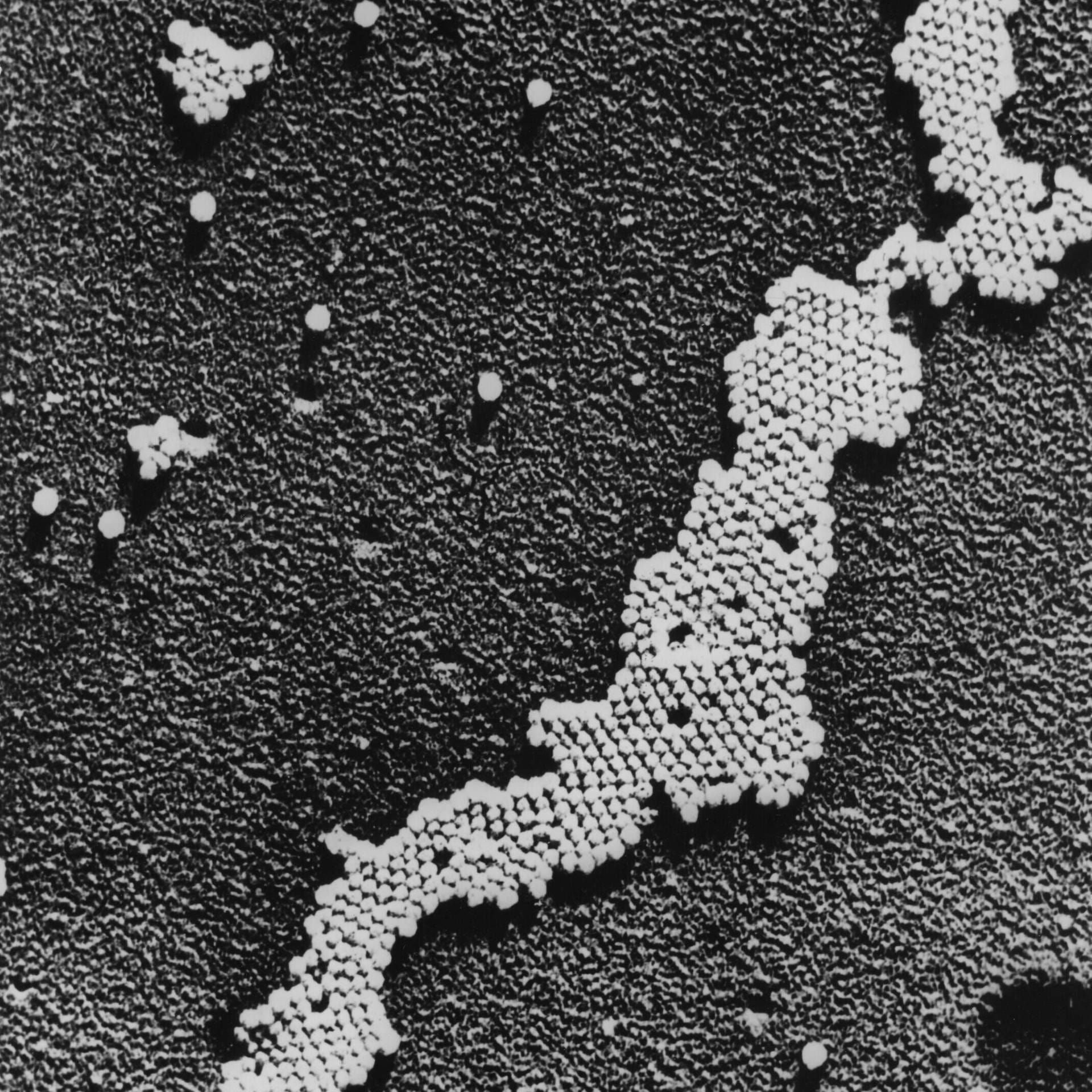 Isolation des Polio-Erregers | 14.1.1953