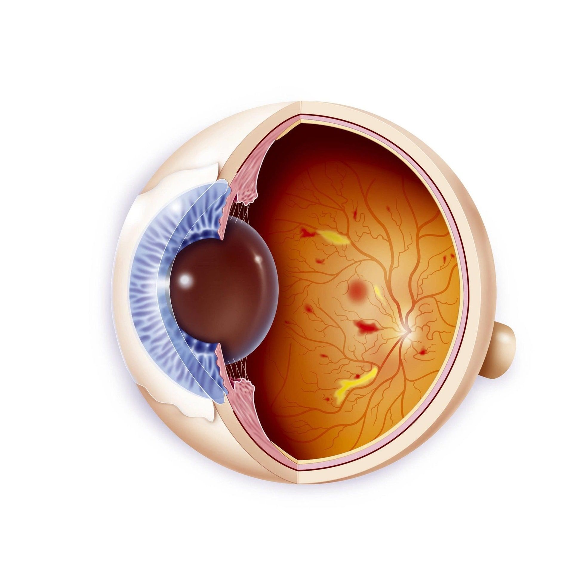 Bei welchen Krankheiten muss ich auf die Augen achten?