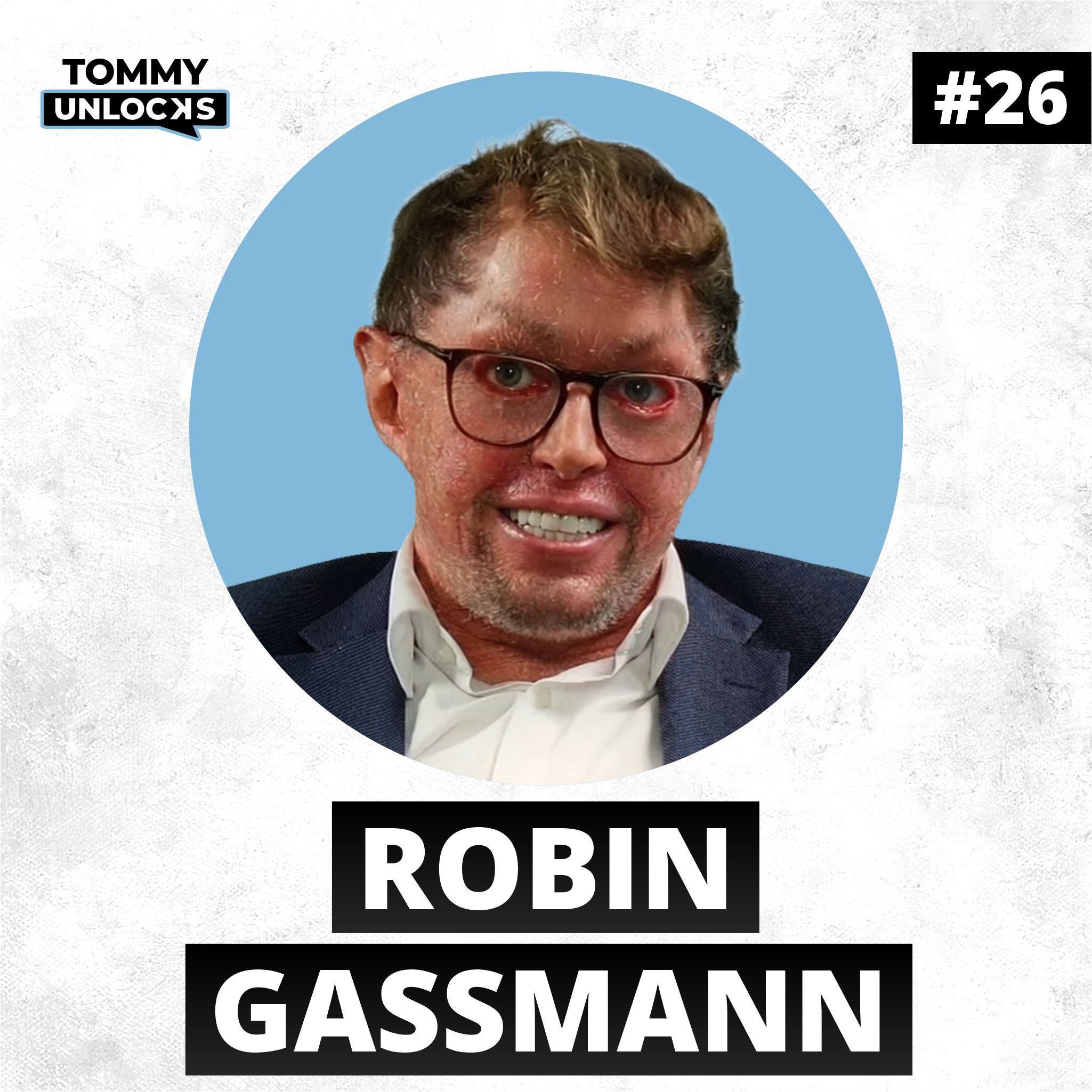 Behindertenwerkstatt?! – Wie Robin Gassmann zum Millionär wurde