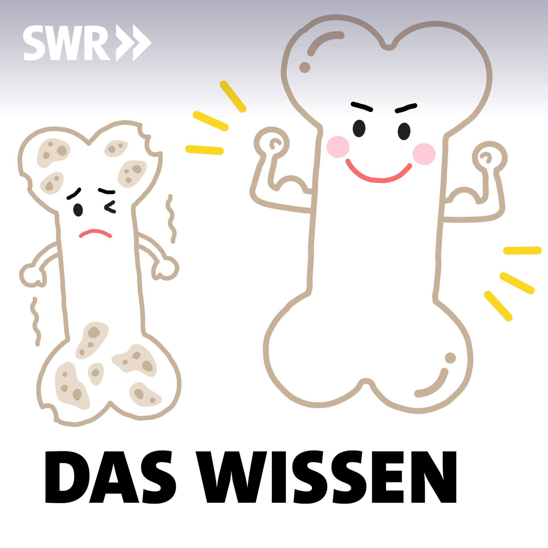 Brüchige Knochen – Wie man Osteoporose vorbeugt