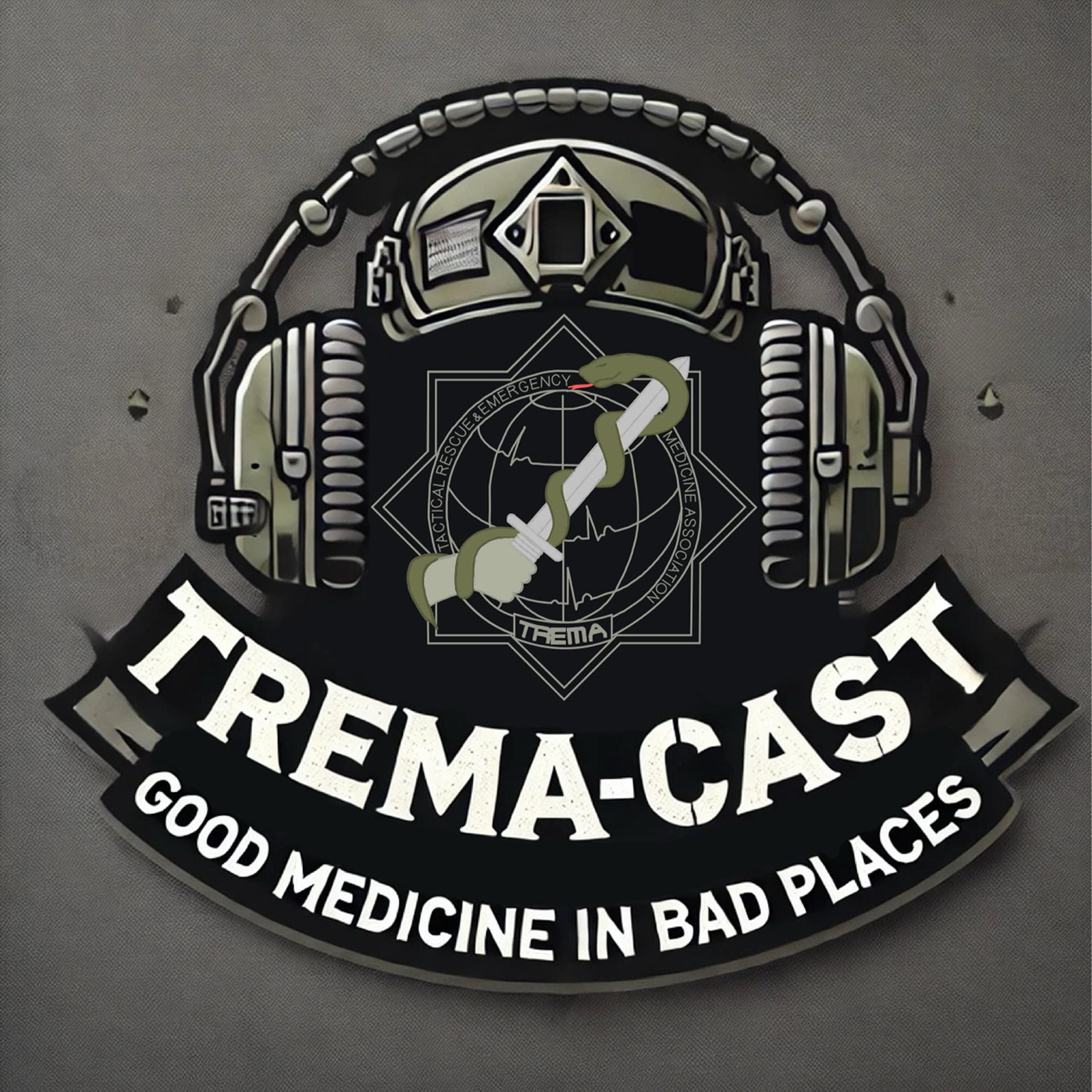 TREMA Cast