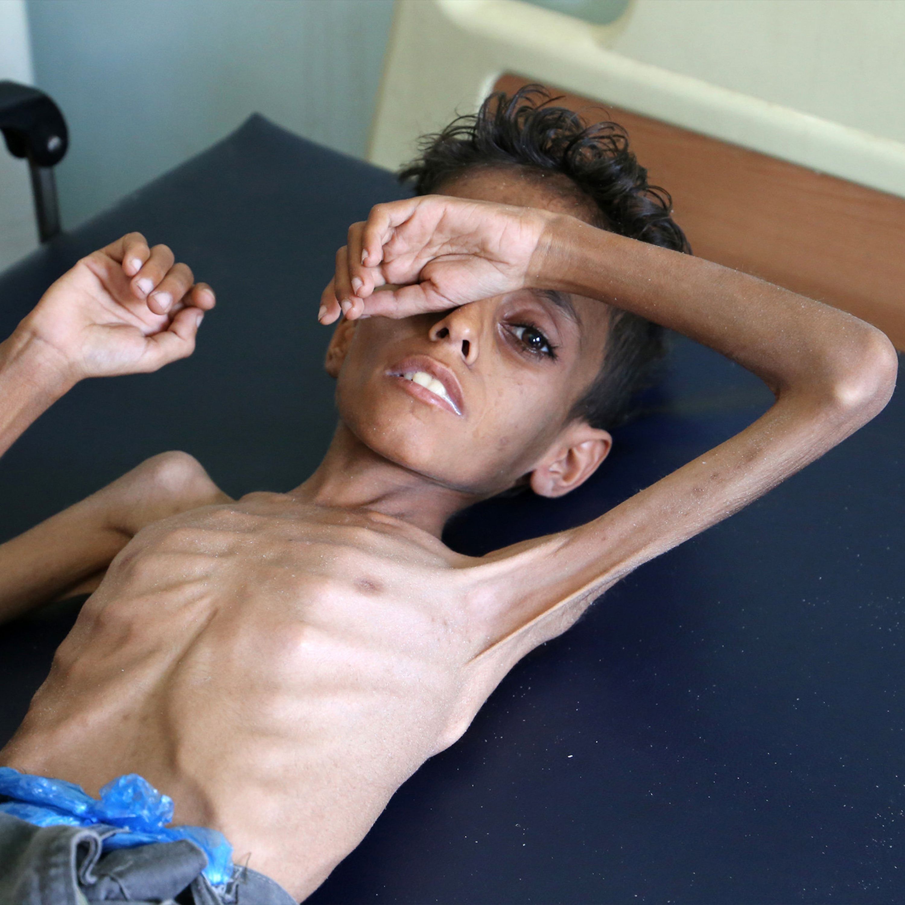 Yemen on the brink