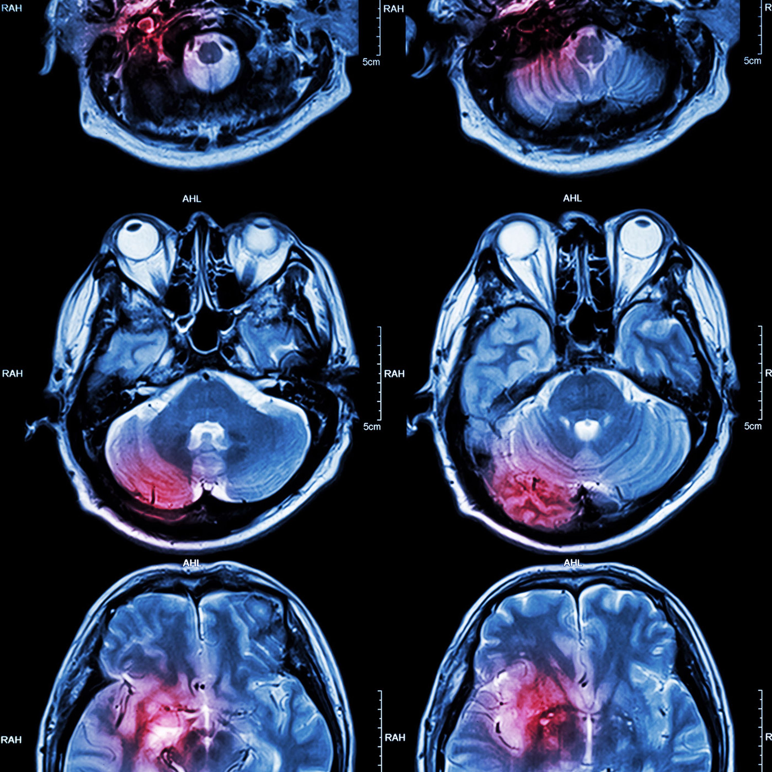 Shining a light on the brain