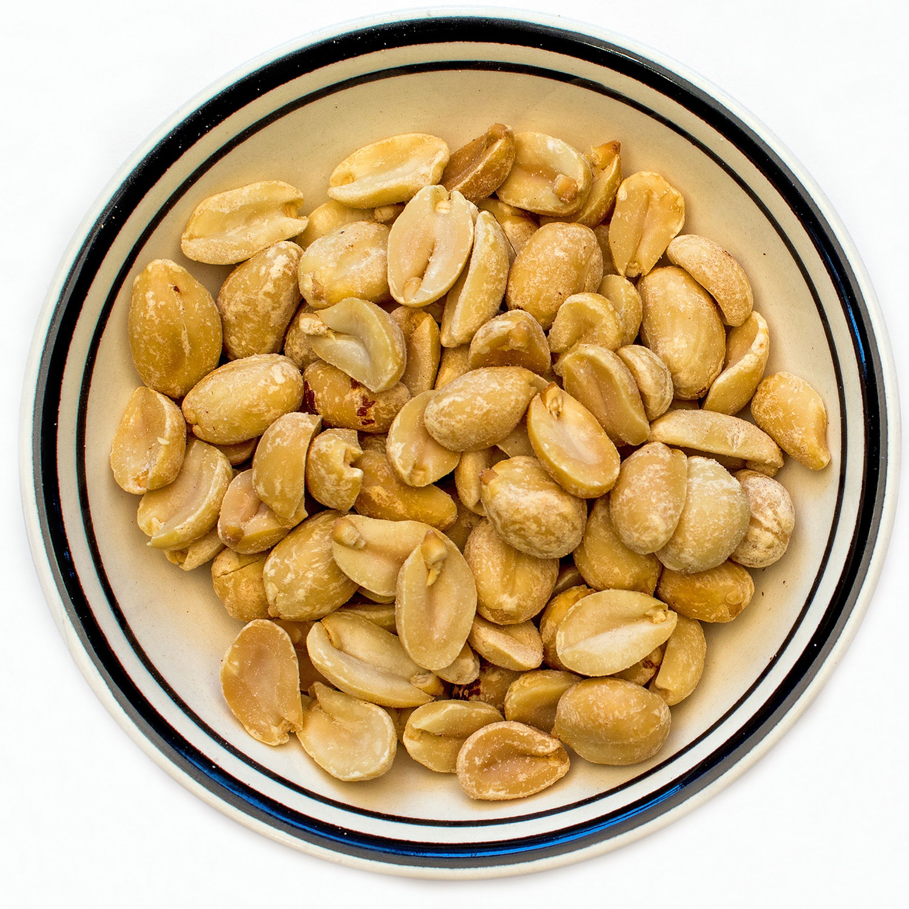 What's behind the rise in food allergies?