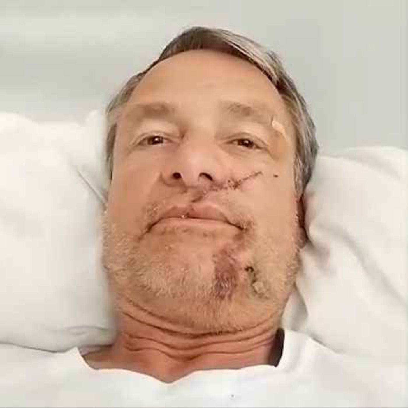 «Der Islamist rammte mir das Messer in den Kopf»: Michael Stürzenberger über den Terror von Mannheim