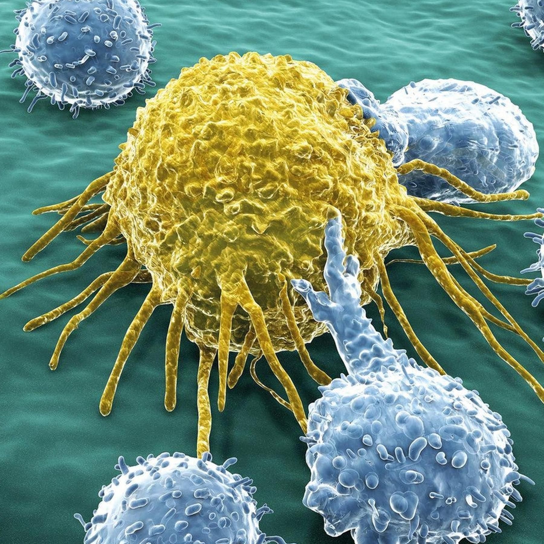 Kampf gegen Darmkrebs - Wie erfolgreich ist die Immuntherapie?