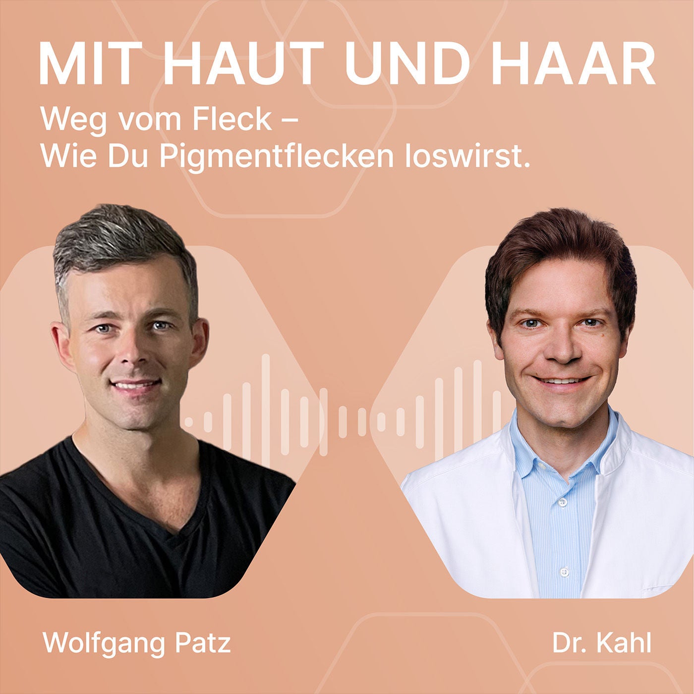Weg vom Fleck – Wie Du Pigmentflecken loswirst.