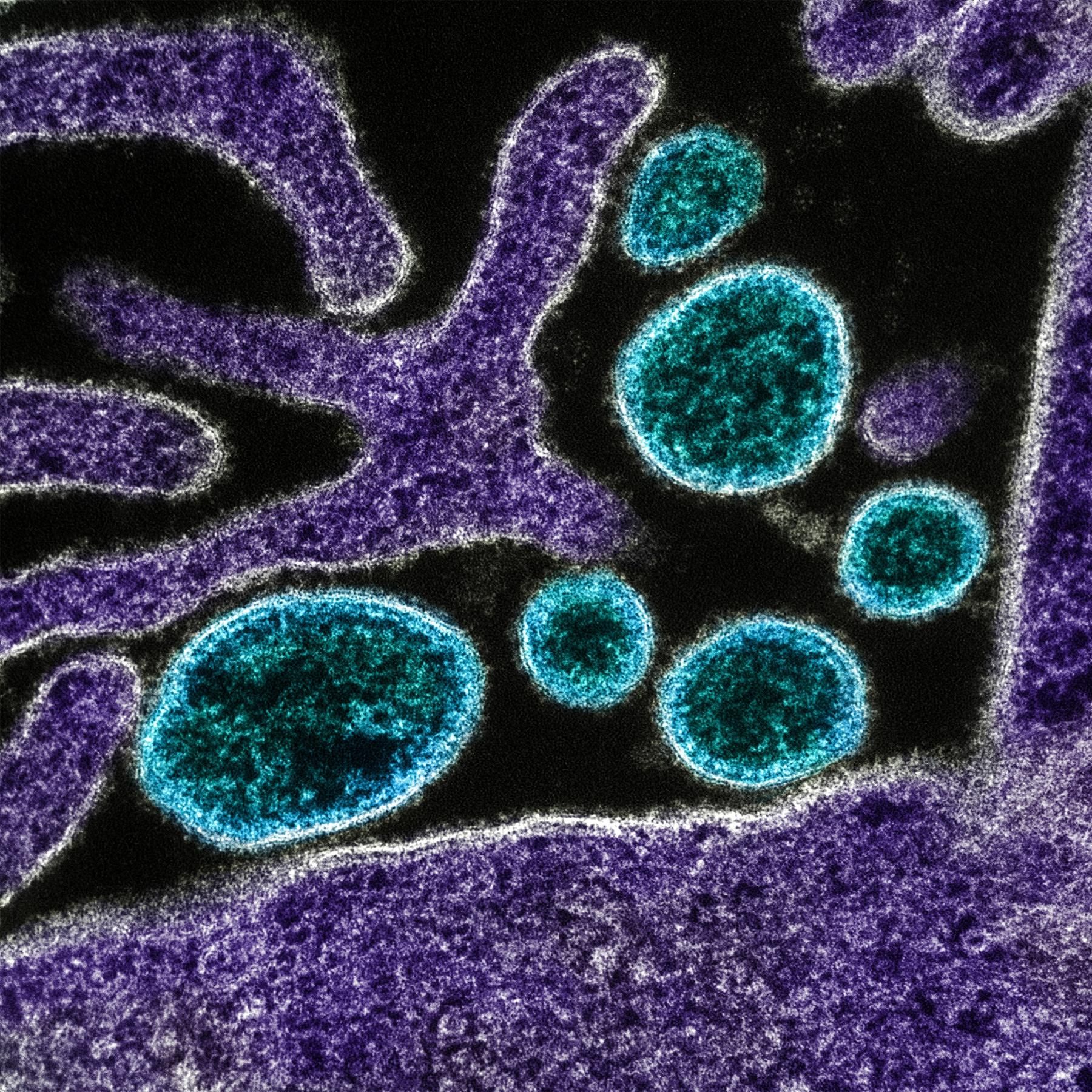 Das neue Corona? - Nipah, Dengue und andere Viren, wie gut sind wir gerüstet?