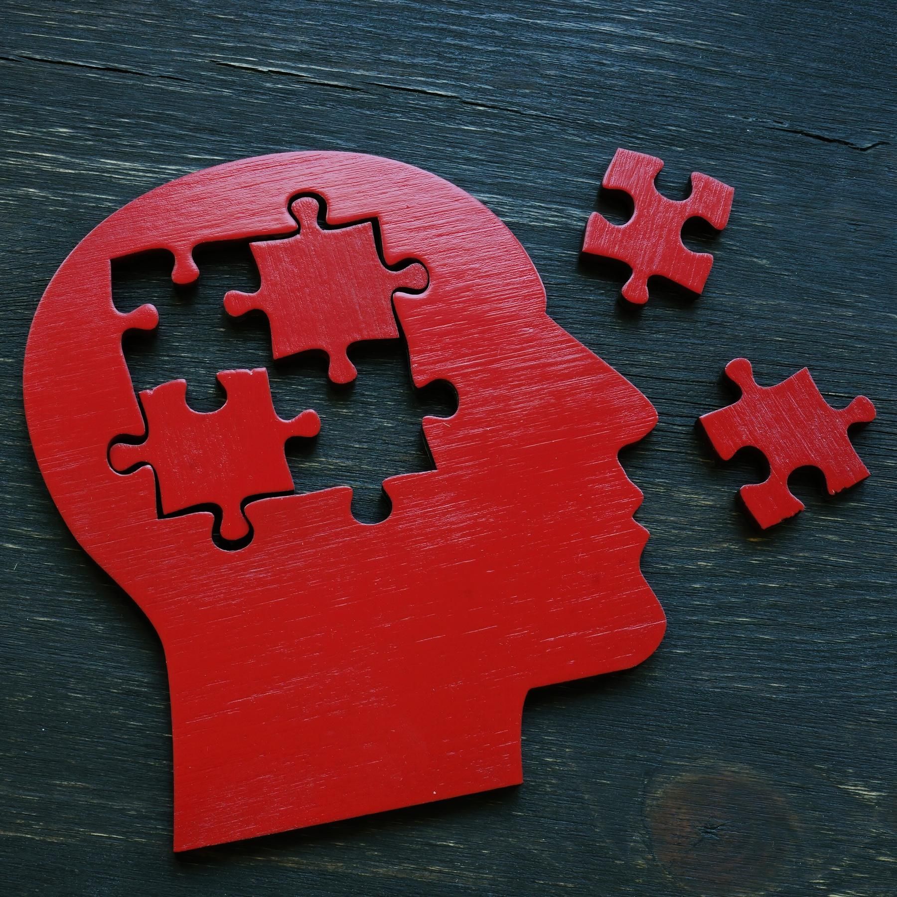 Spektakuläre Gehirnsimulation - Ist das Human Brain Project gescheitert?