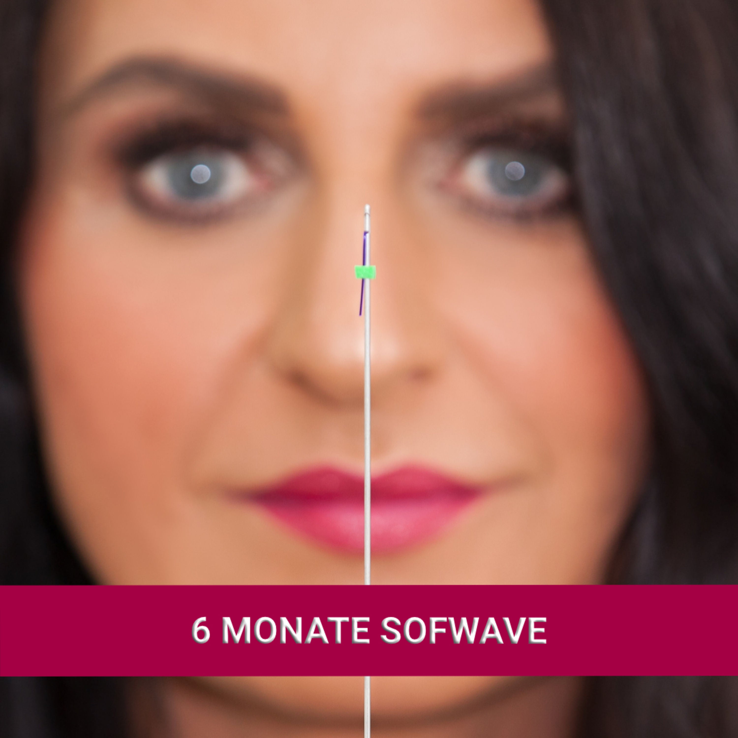 6 Monate Sofwave