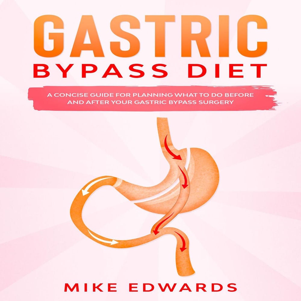 Gastric Bypass Diet - A Concise Guide for Planning What to Do Before and After your Gastric Bypass Surgery