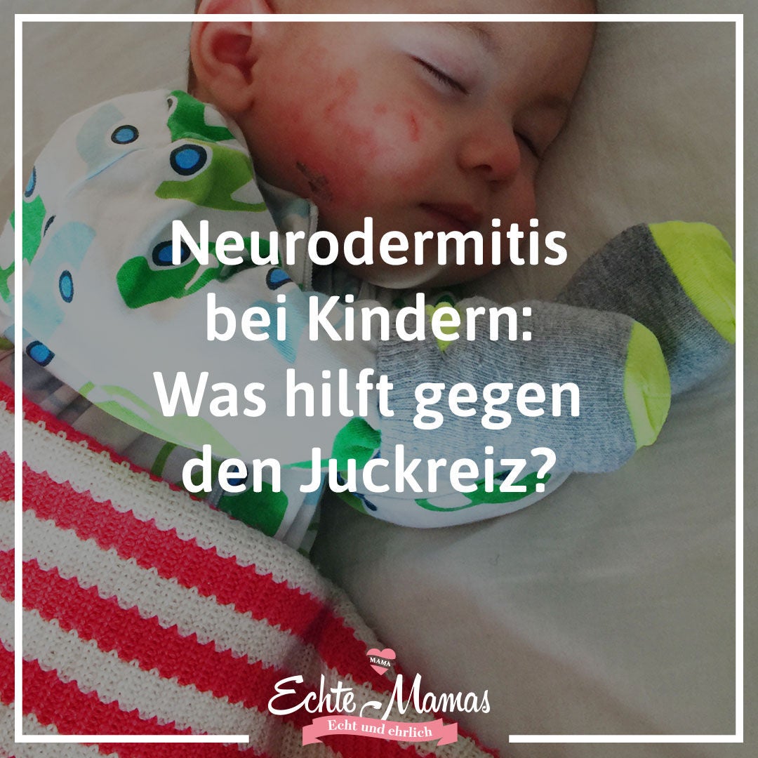 # 14: Neurodermitis bei Kindern: Was hilft gegen den Juckreiz?