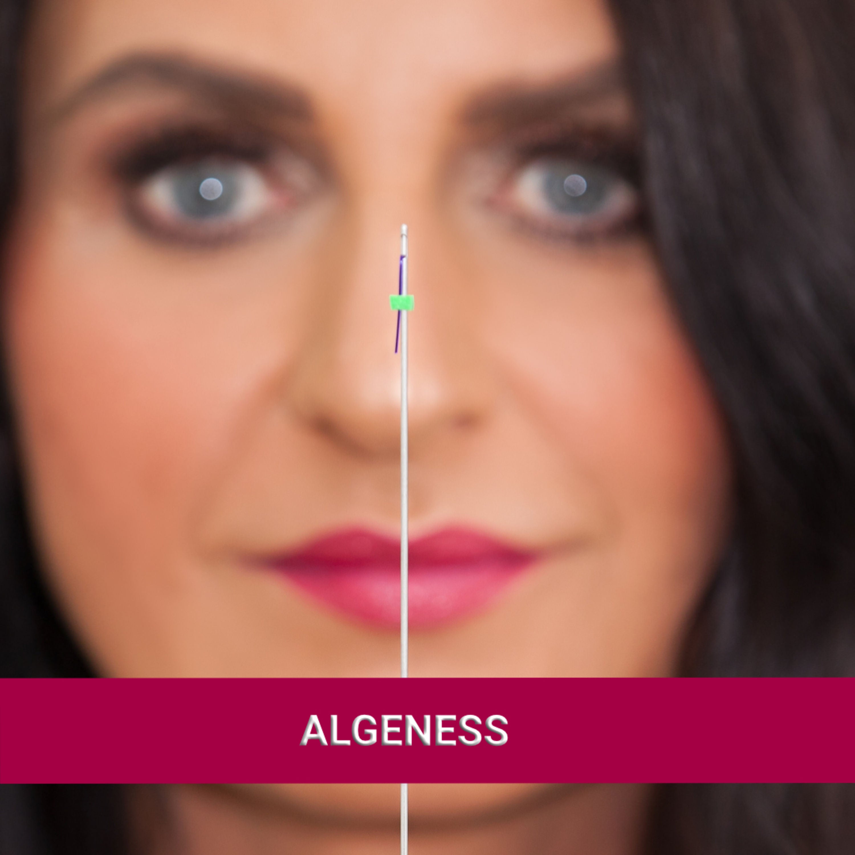 Algeness