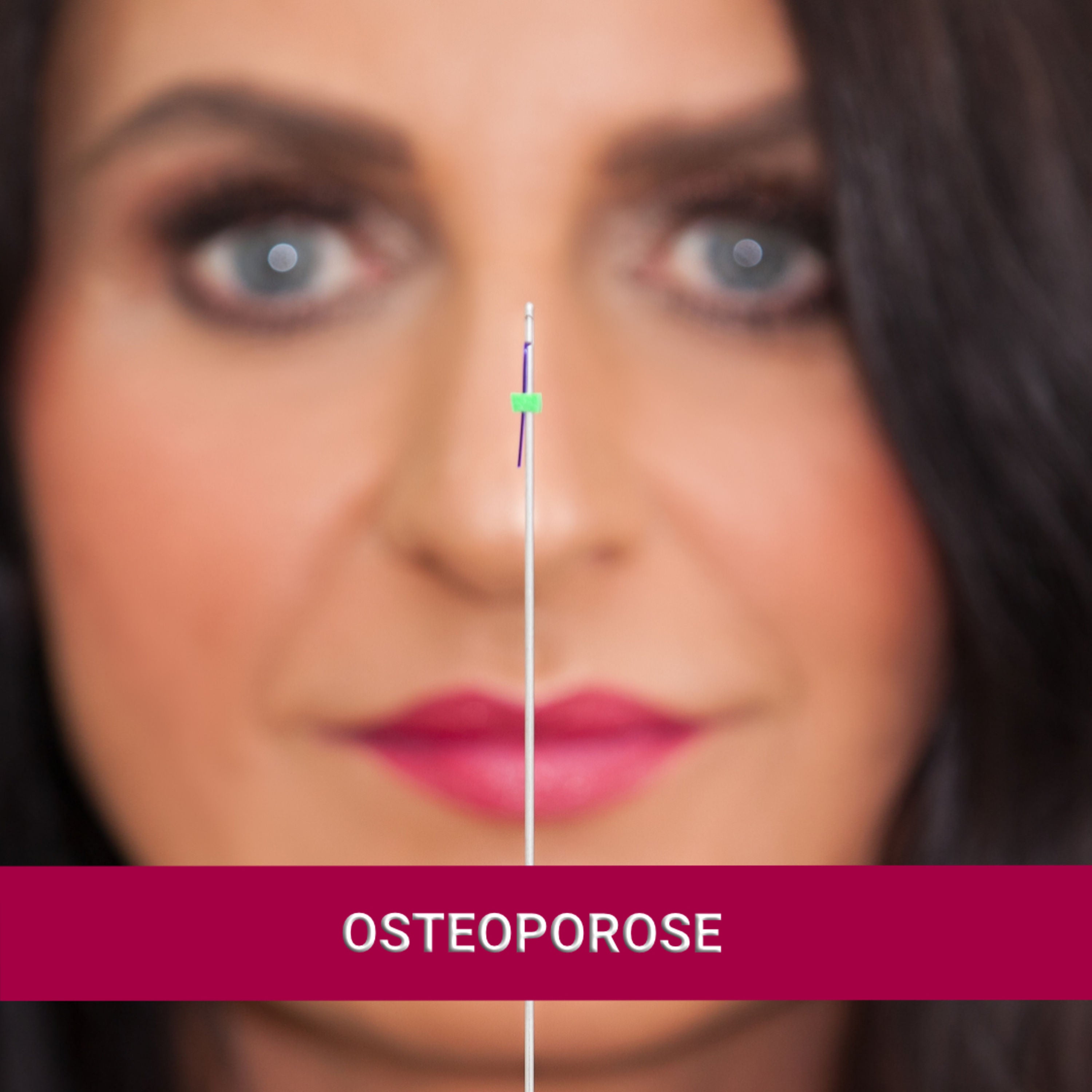 Osteoporose