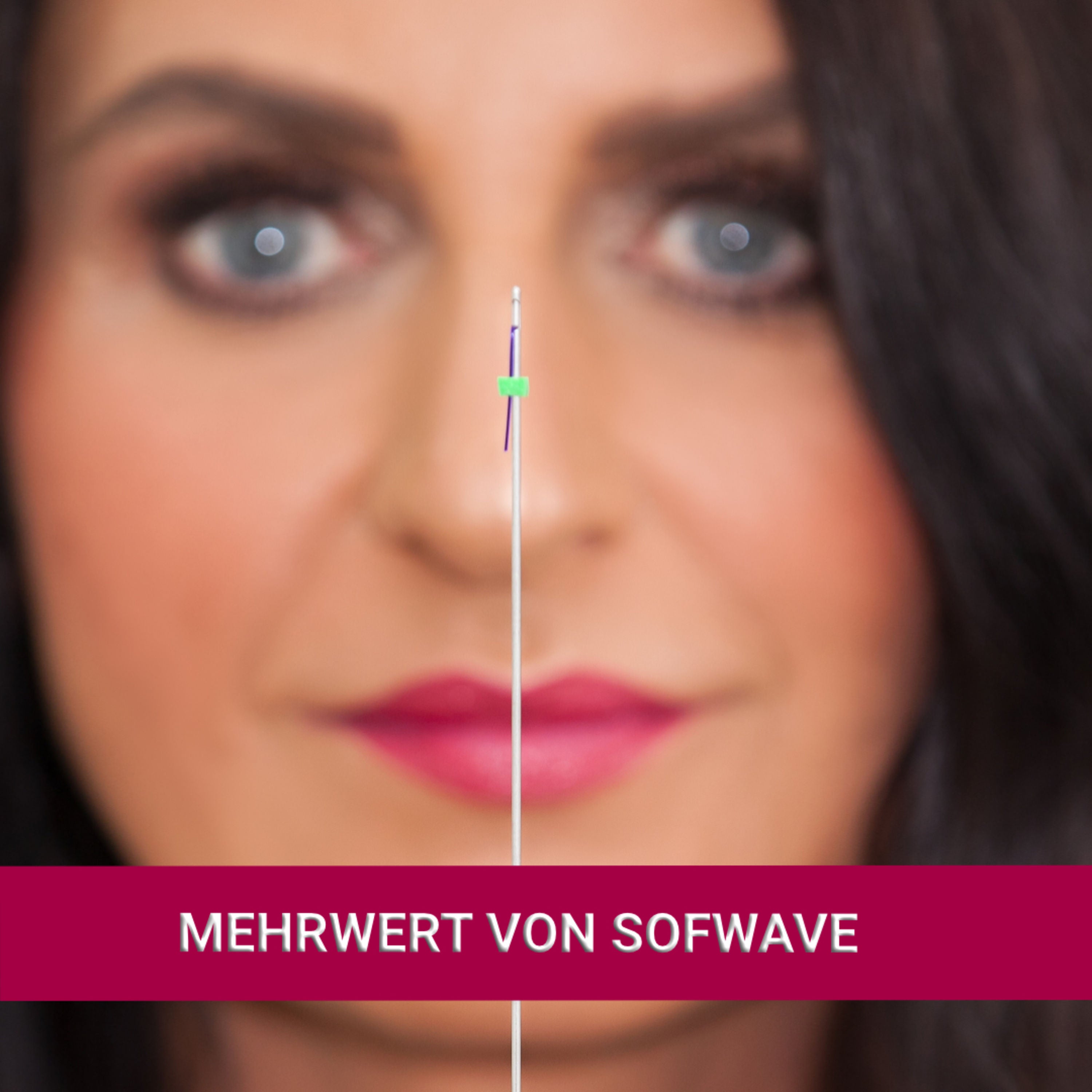 Mehrwert von Sofwave