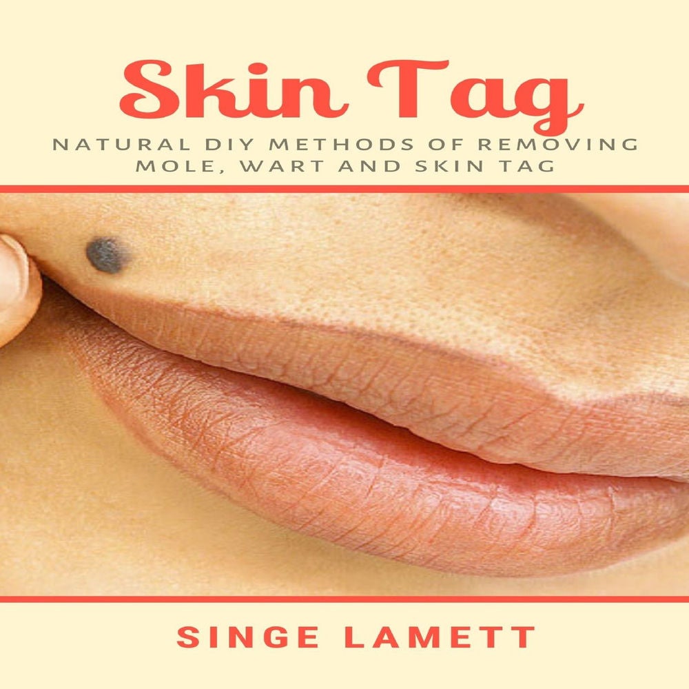 Skin Tag - Natural DIY Methods of removing Mole, Wart and Skin Tag