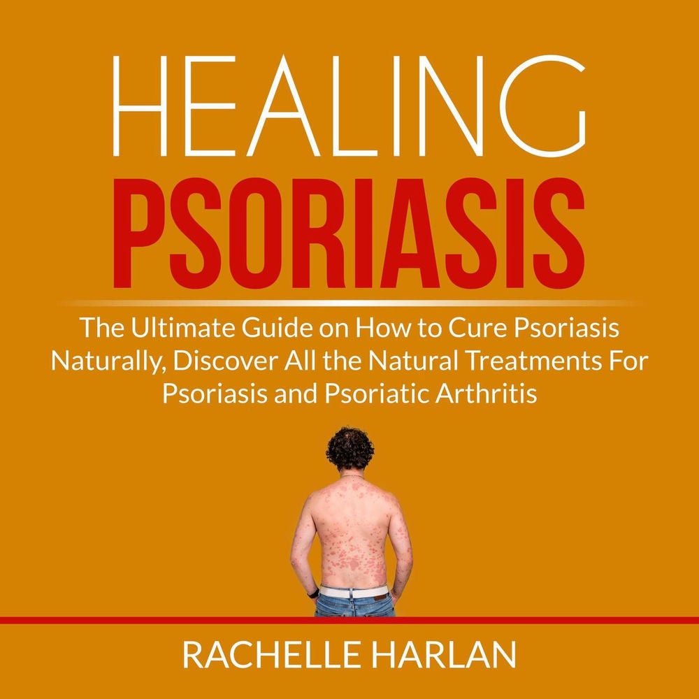 Healing Psoriasis - The Ultimate Guide on How to Cure Psoriasis Naturally, Discover All the Natural Treatments For Psoriasis and P