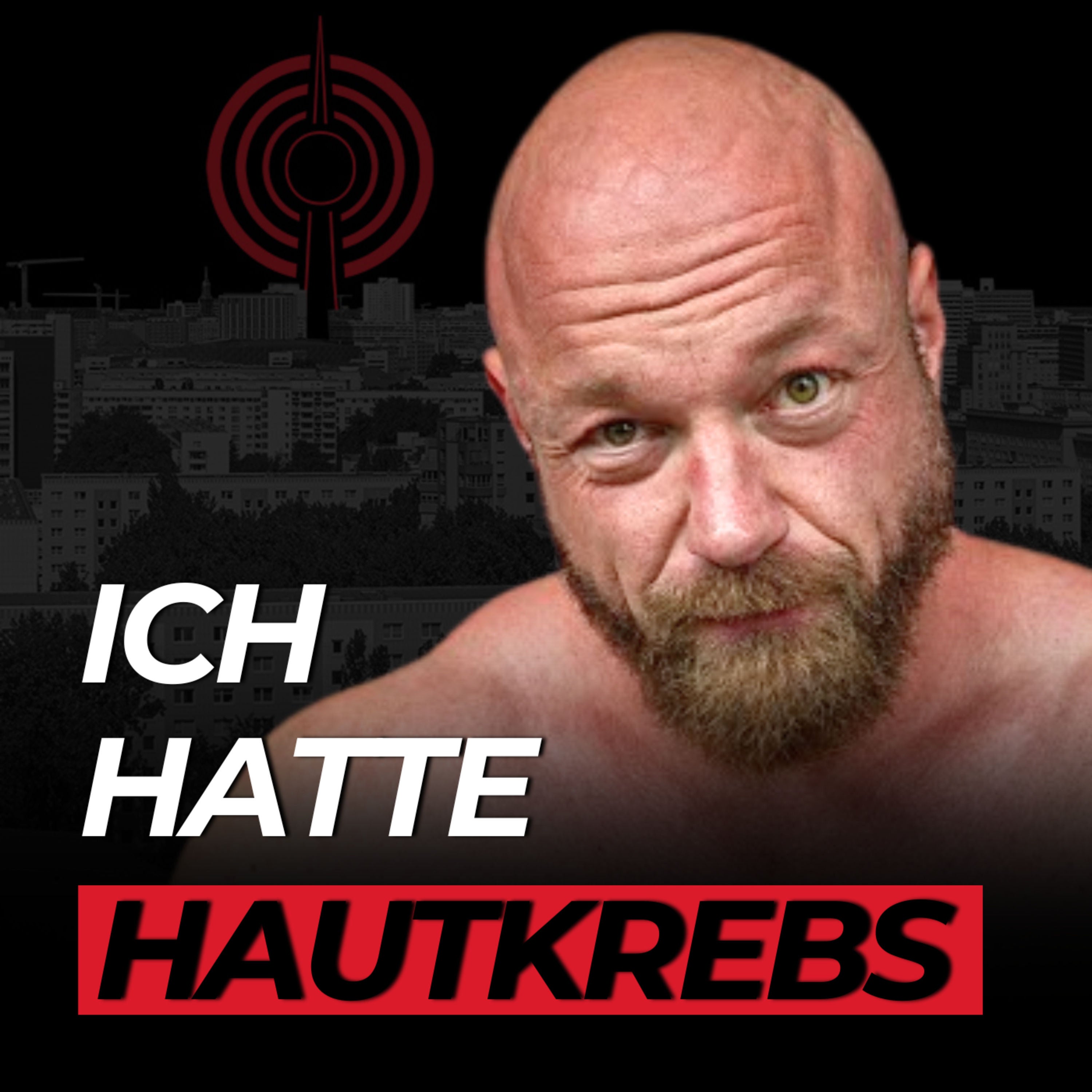 Johannes Luckas: Hautkrebs, Drogen und wie Fitness sein Leben verändert hat