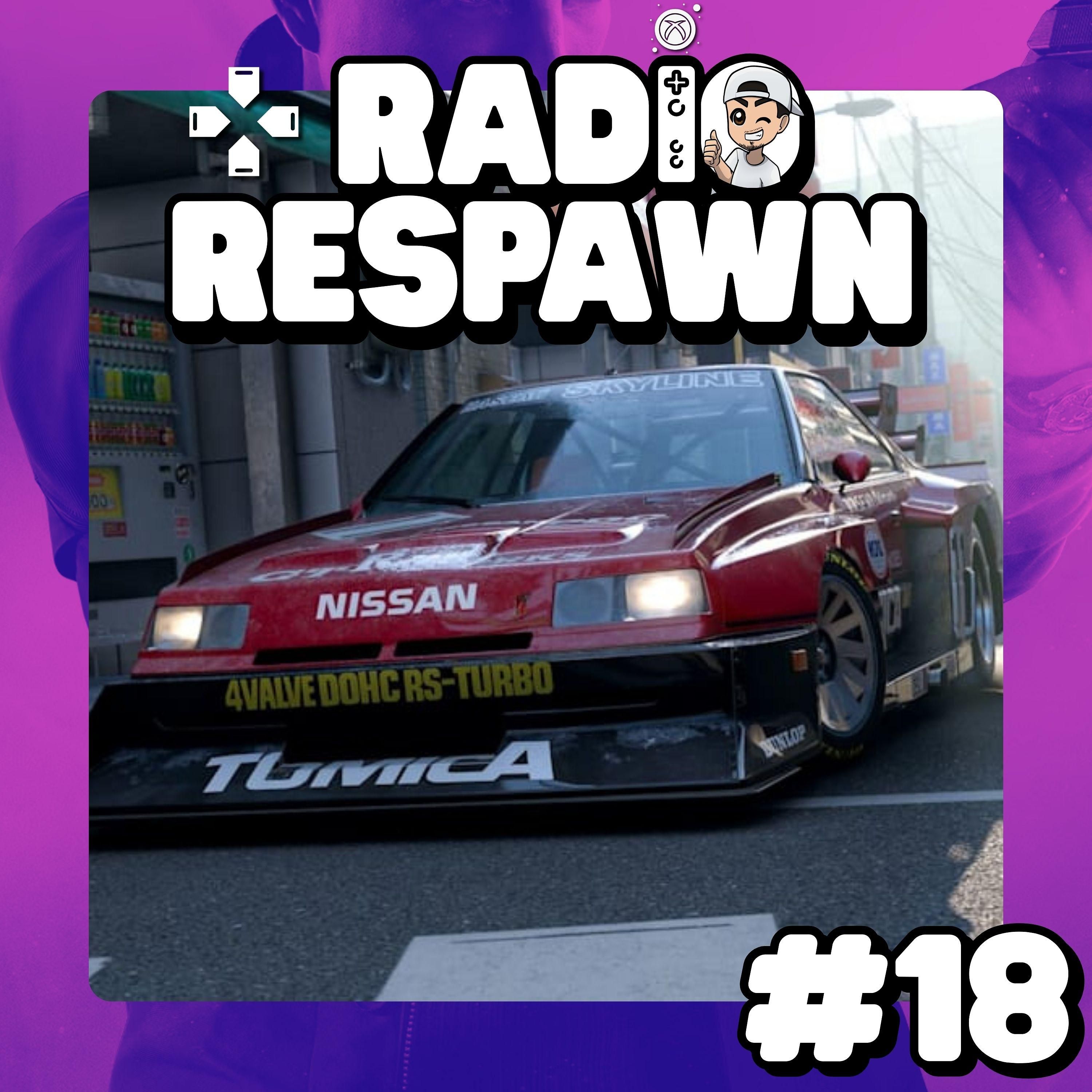 Dokomi-Fazit & Meinung zu Forza Horizon 6 und 007 First Light | Radio Respawn #18