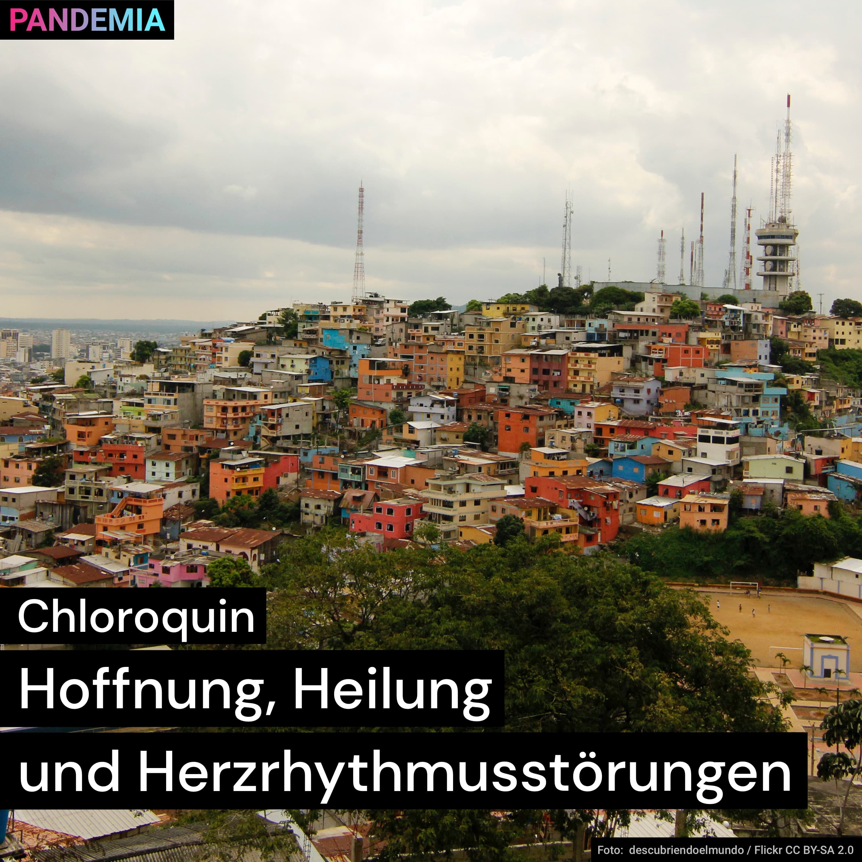 Chloroquin | Hoffnung, Heilung und Herzrhythmusstörungen