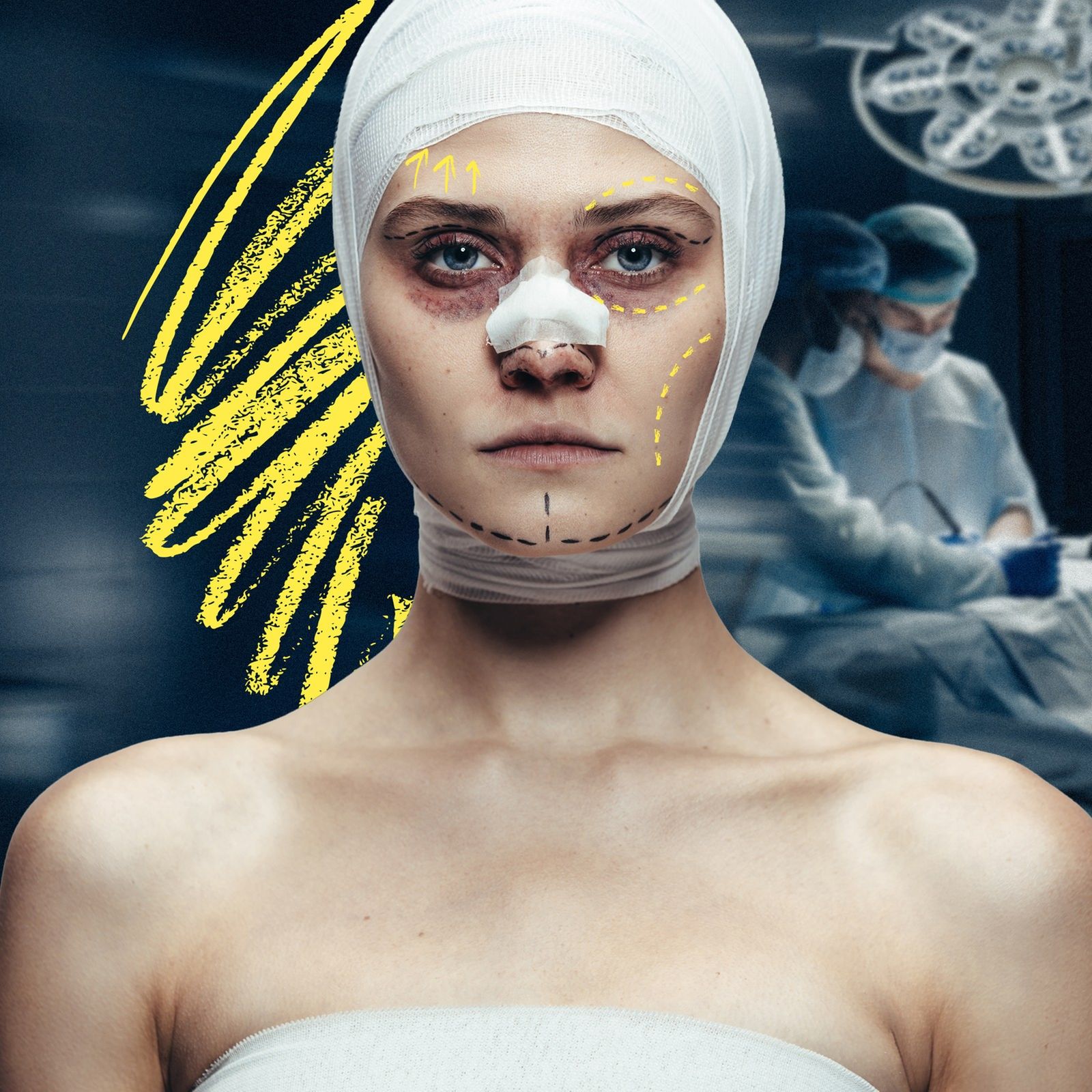 Pfusch bei Beauty OPs? "Ich sah aus, als käme ich vom Schlachter”