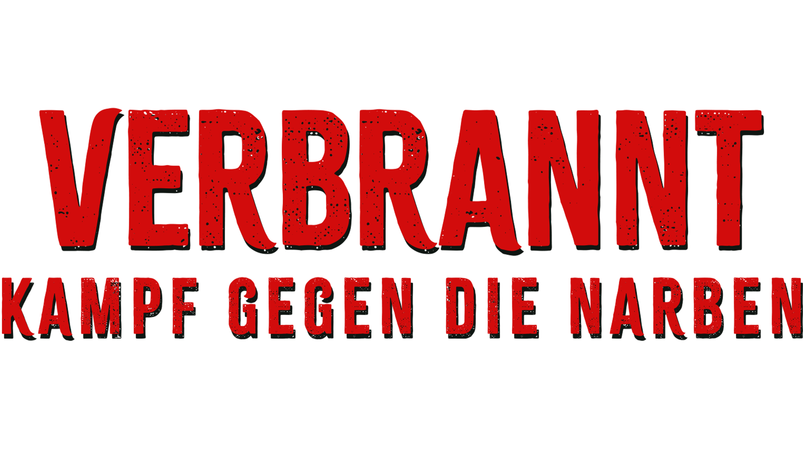 VERBRANNT - Kampf gegen die Narben!