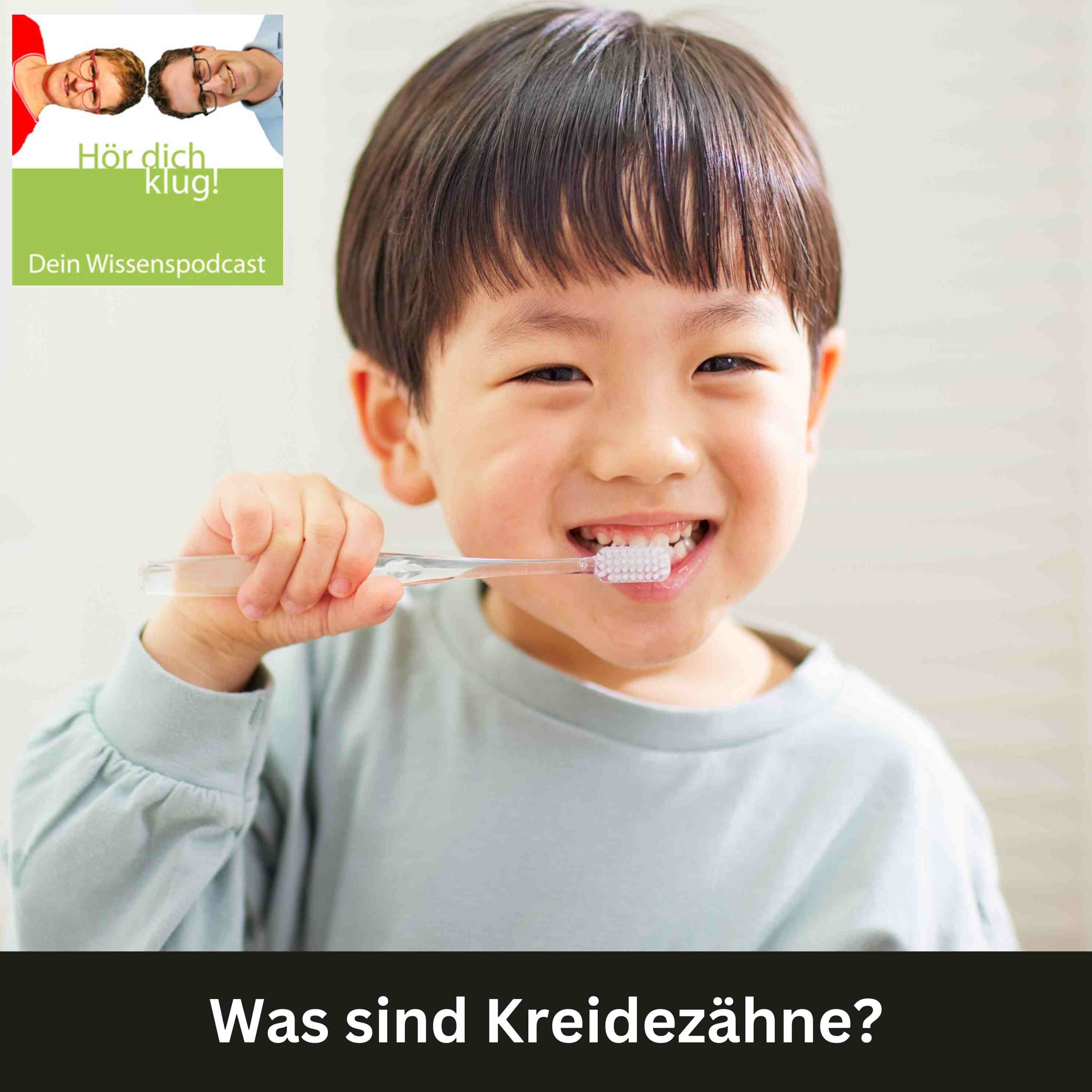 Was sind Kreidezähne?