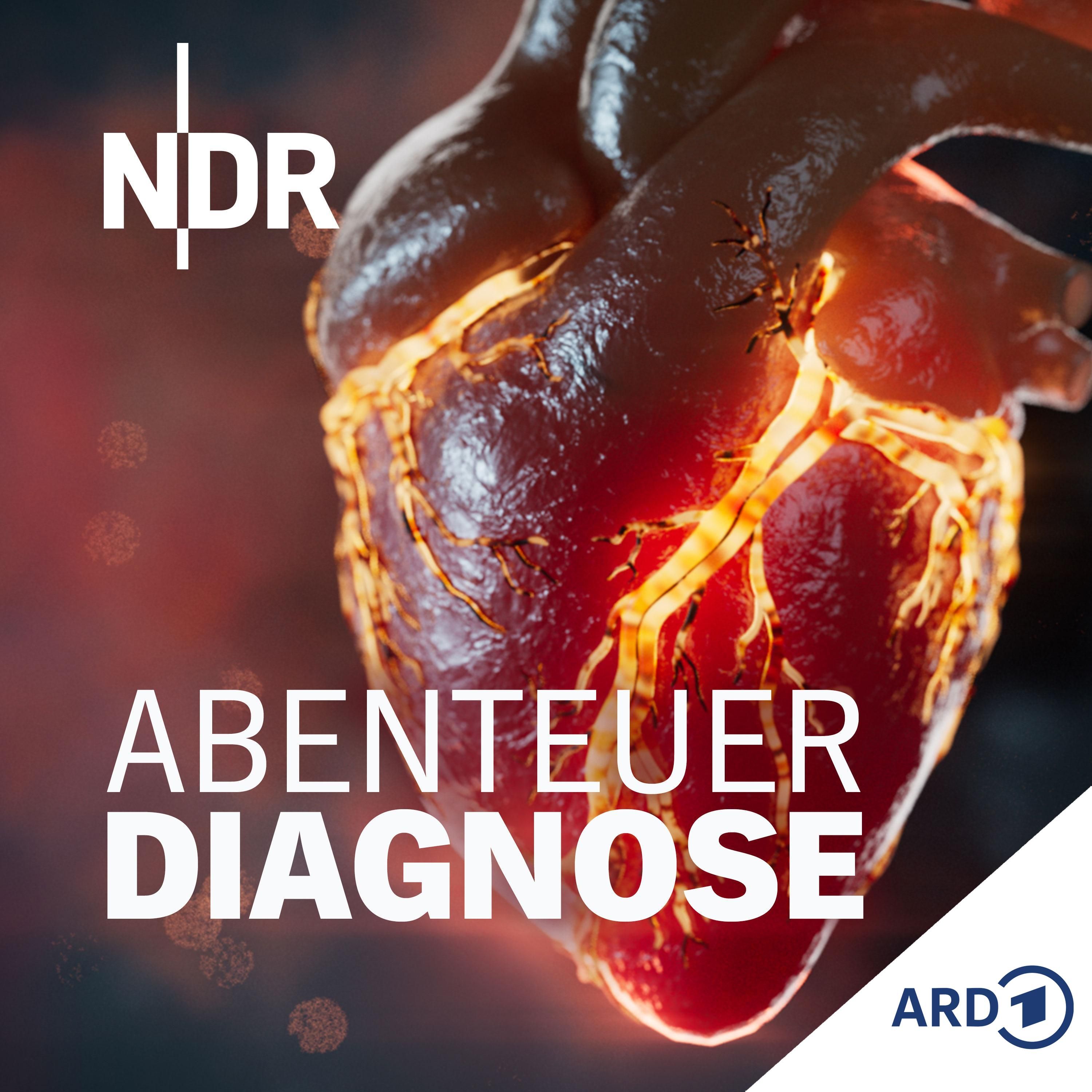 (32) Das trojanische Pferd