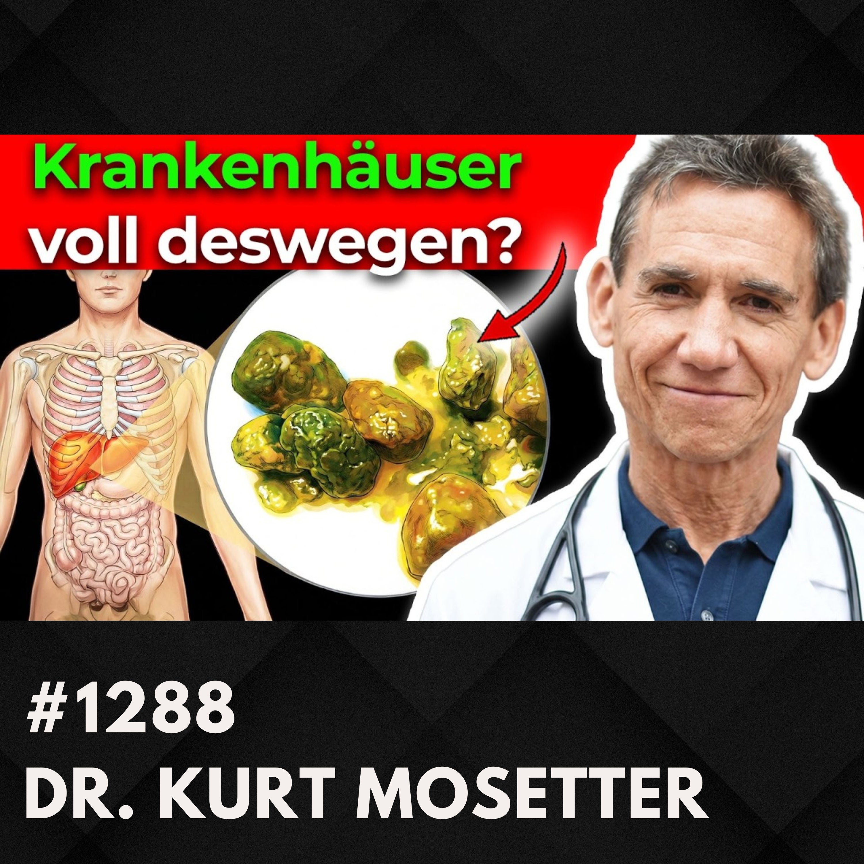 Fettleber: Was viele nicht wissen | Dr. Kurt Mosetter #1288