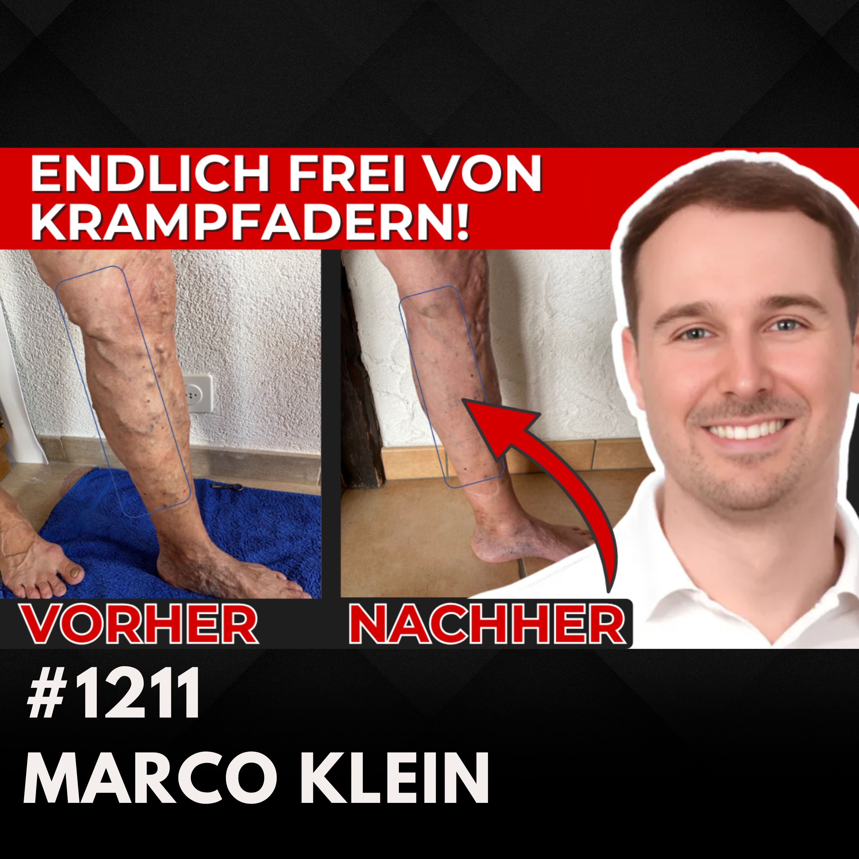 Diese Matte polarisiert | Marco Klein #1211