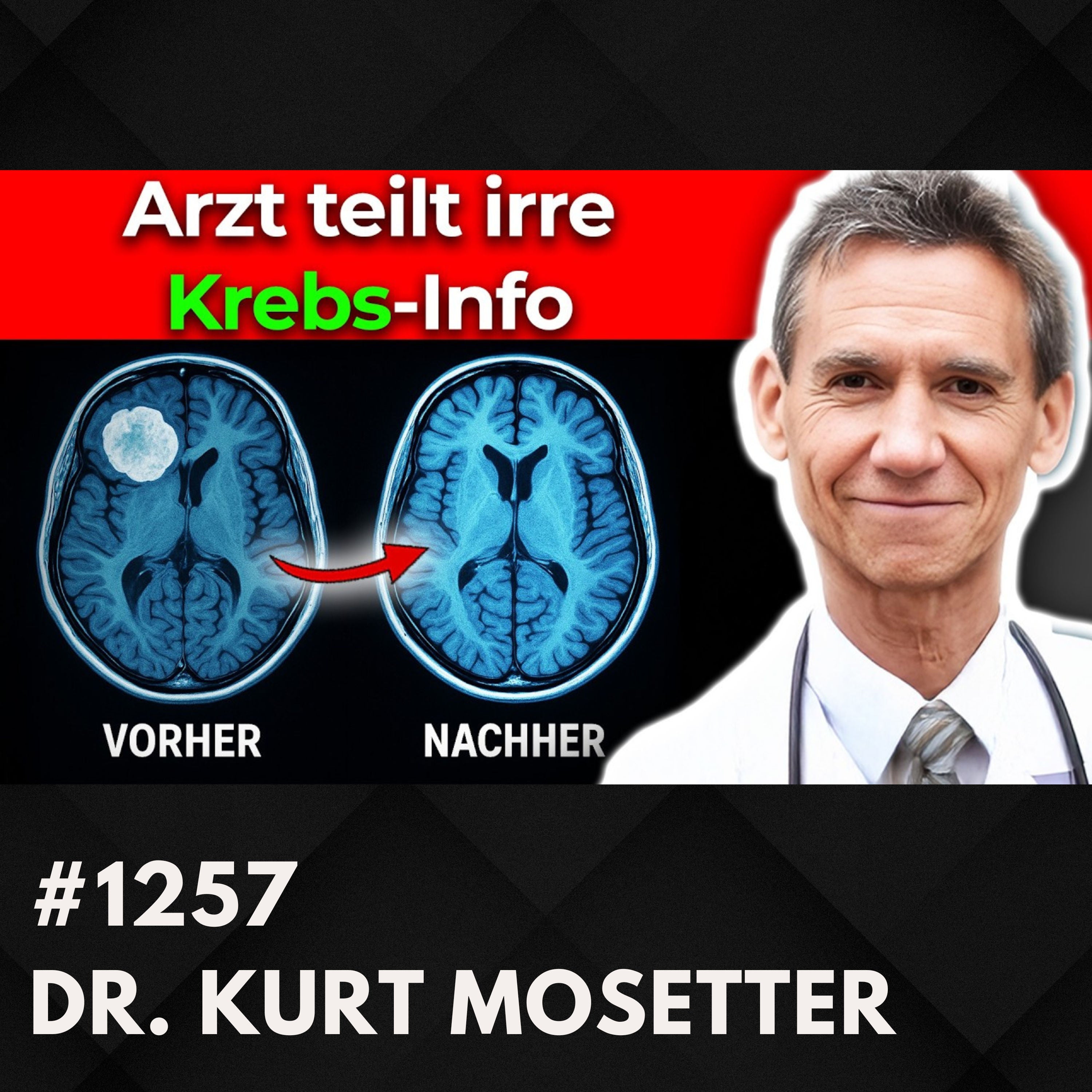 Dieser Zucker überrascht viele Forscher | Dr. Kurt Mosetter #1257
