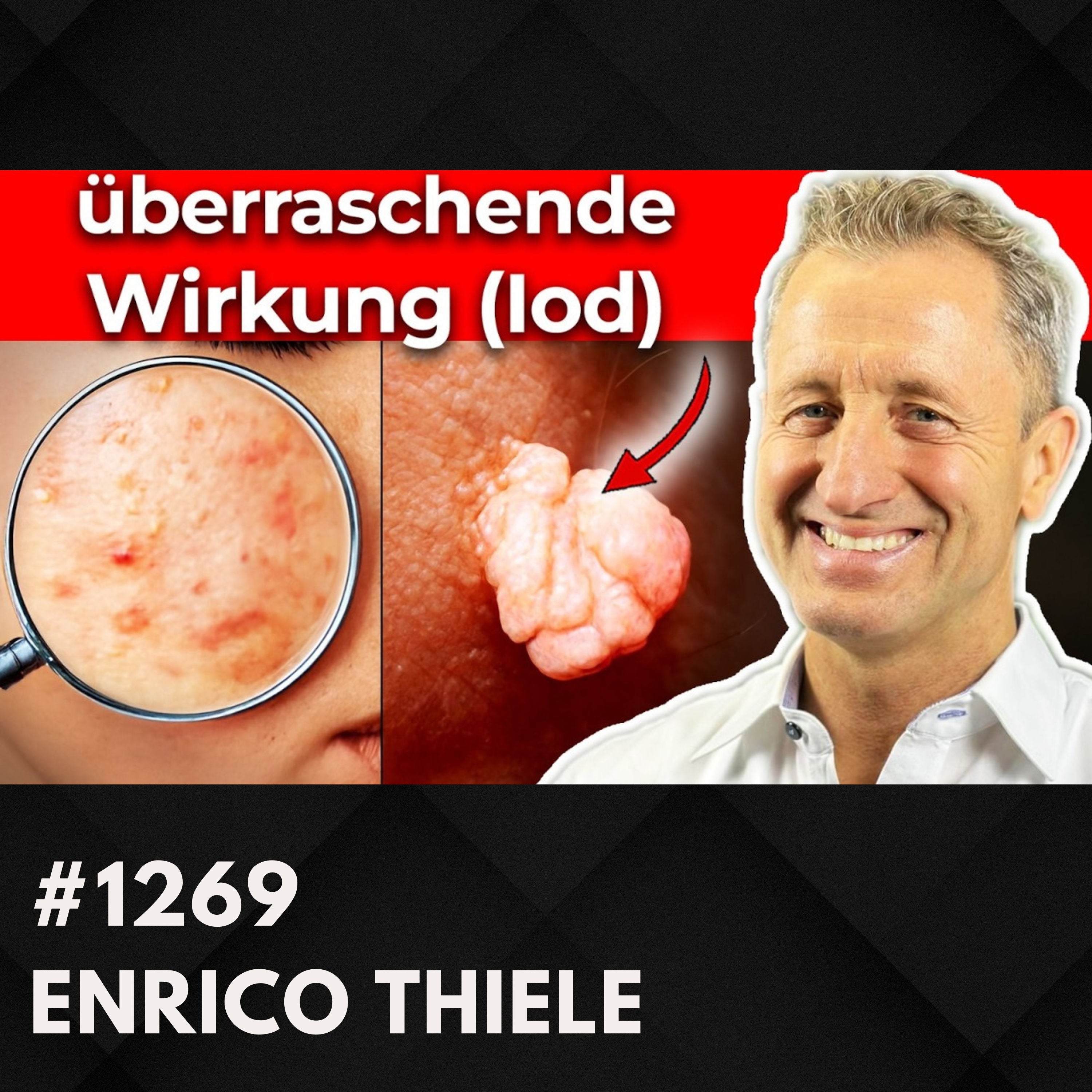 Schilddrüse: Was viele falsch verstehen | Enrico Thiele #1269