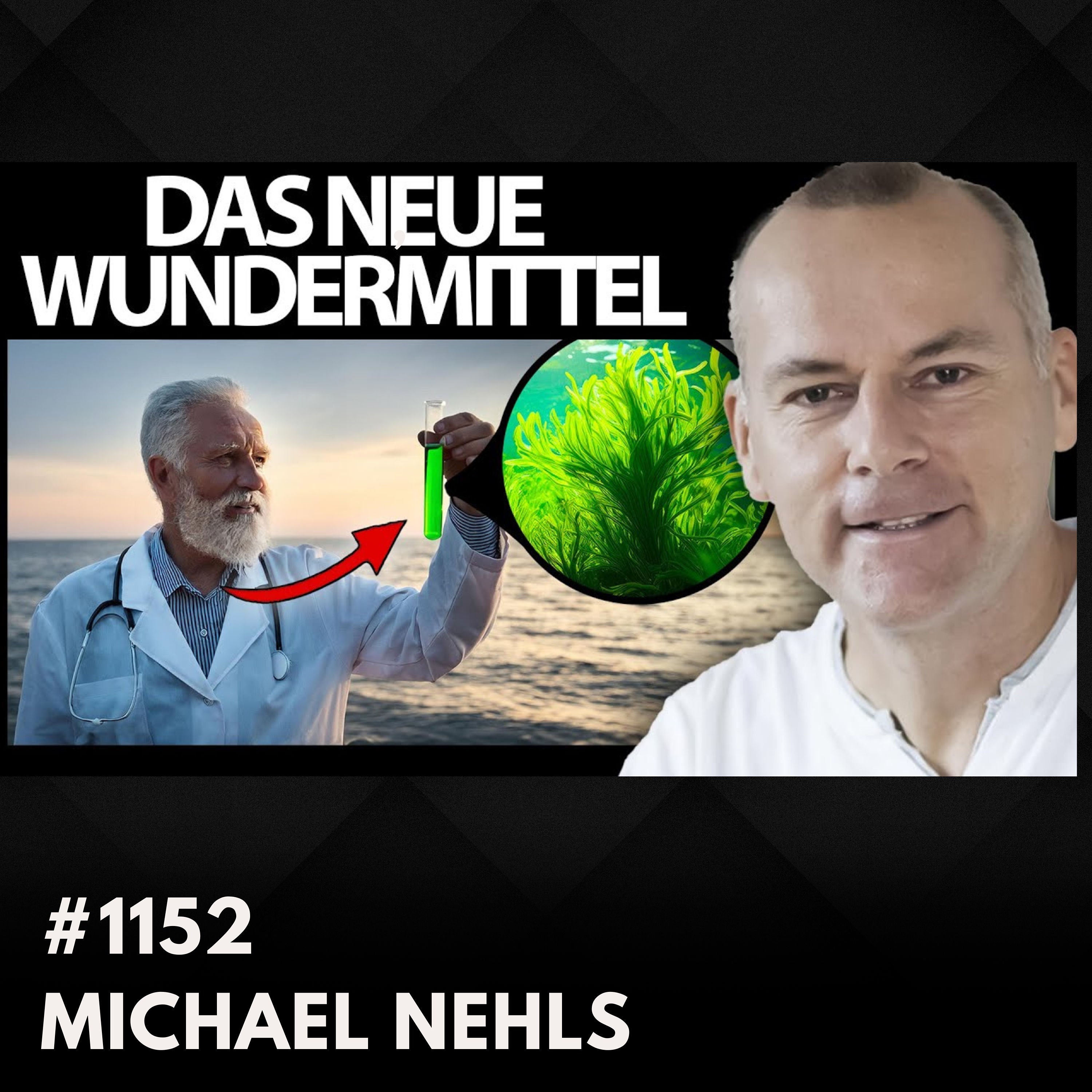 Diese Ernährung empfiehlt der Omega-3-Experte | Dr. Michael Nehls #1152