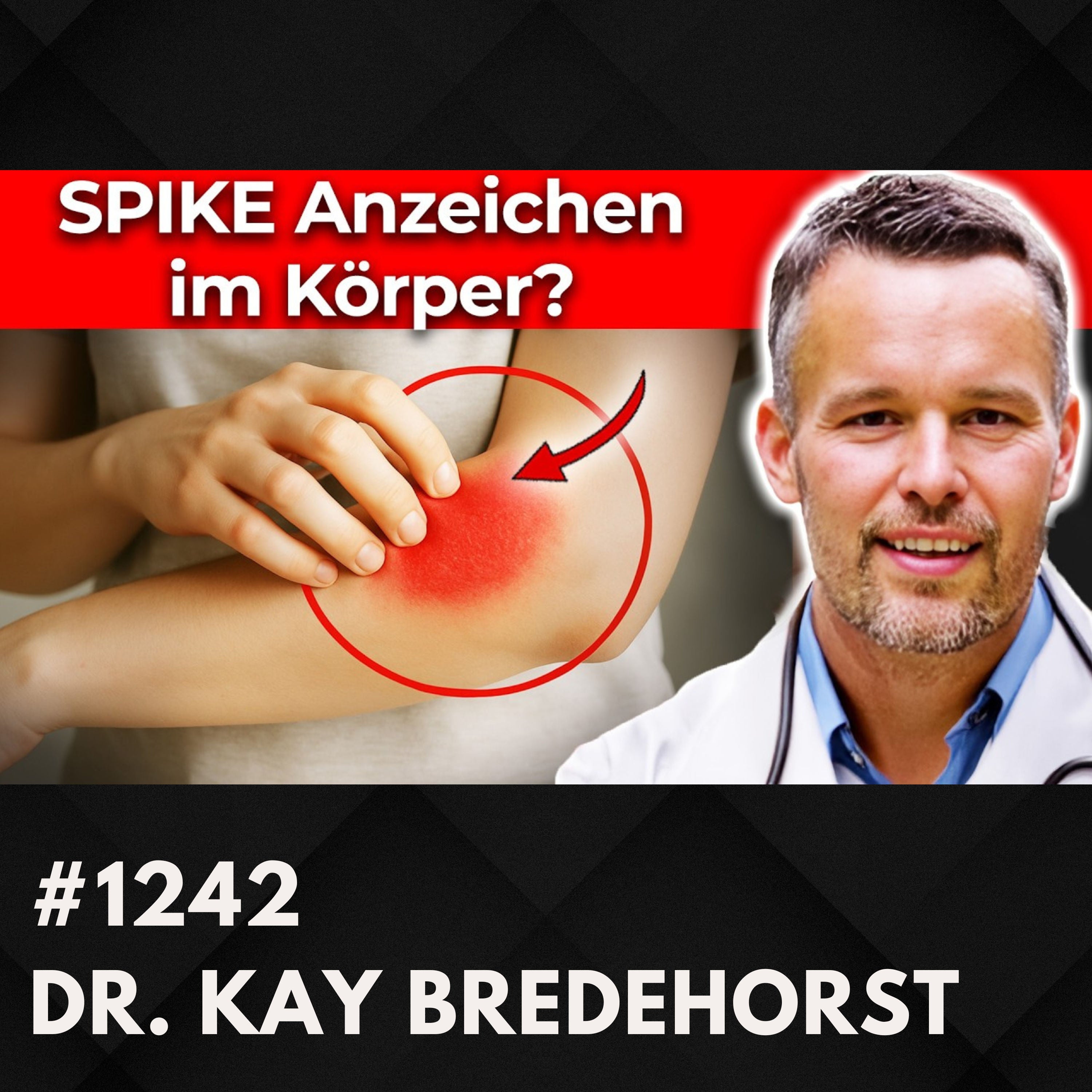 Histaminintoleranz: Ist Ernährung wirklich der Hauptfaktor? | Dr. Kay Bredehorst #1242