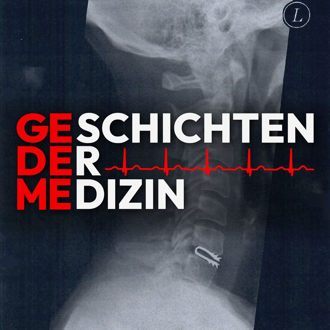 #030 Al Capones größter Kampf