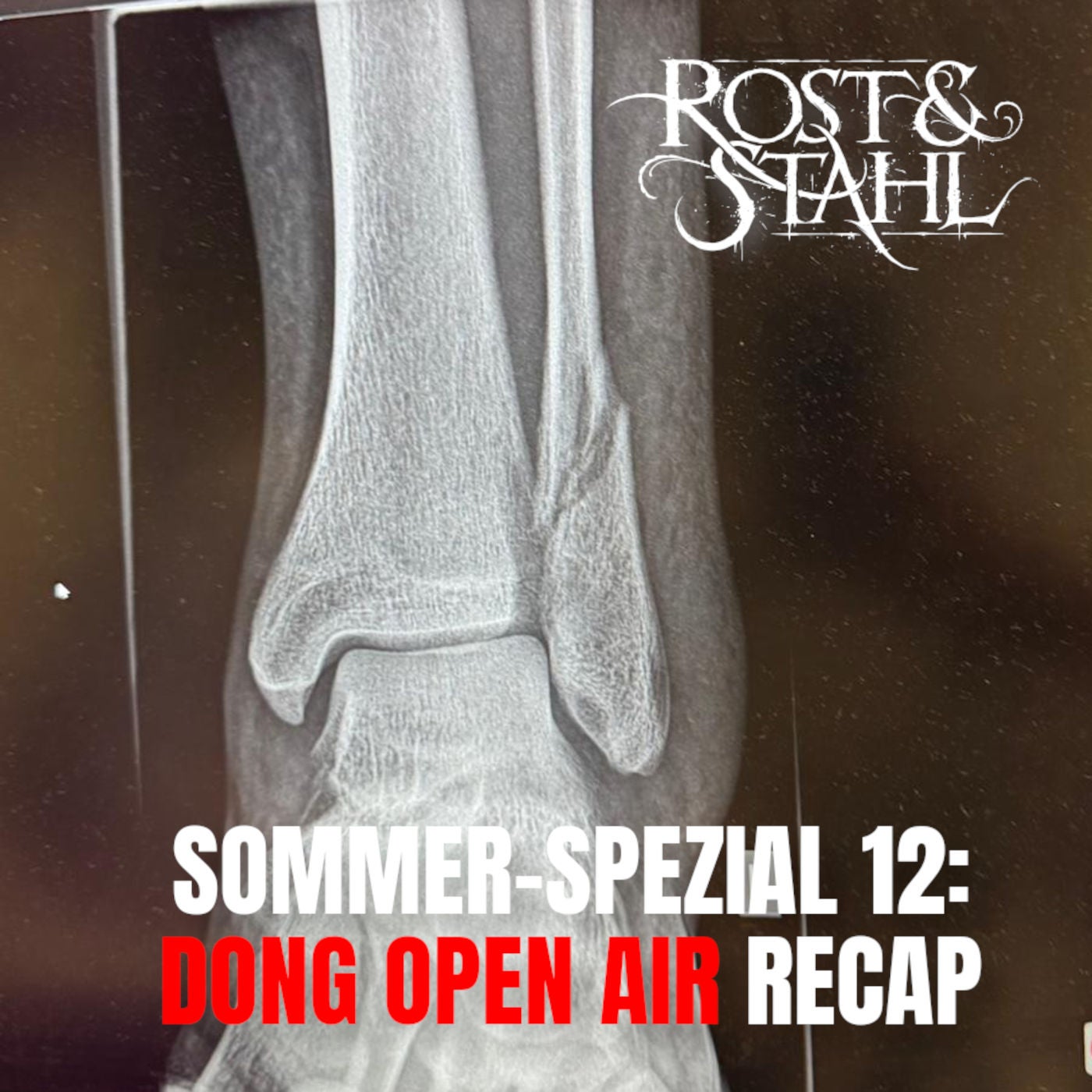 Sommer-Spezial 12: Dong Open Air Recap