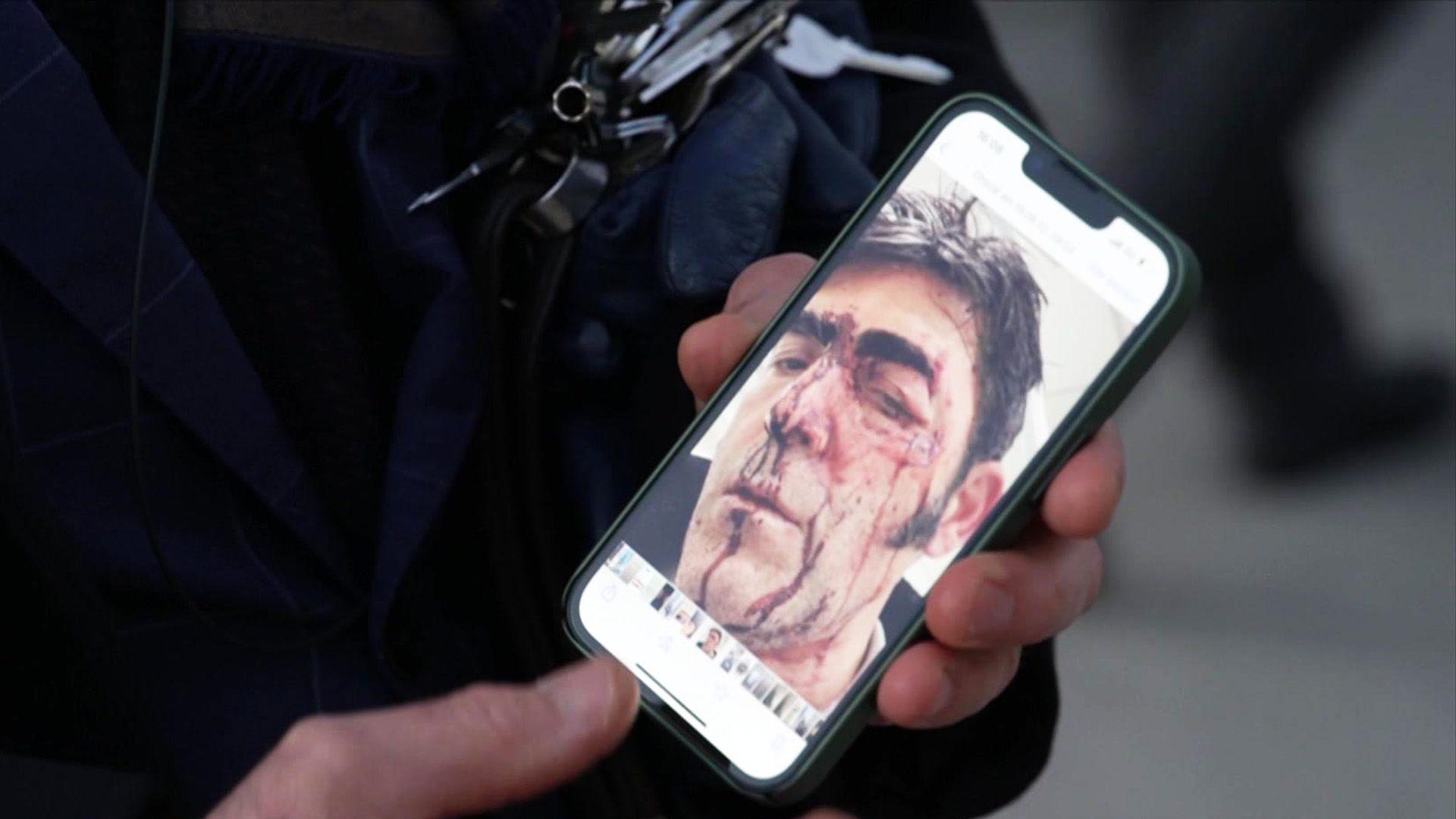Trauma Raubüberfall - bedroht, genötigt, beklaut