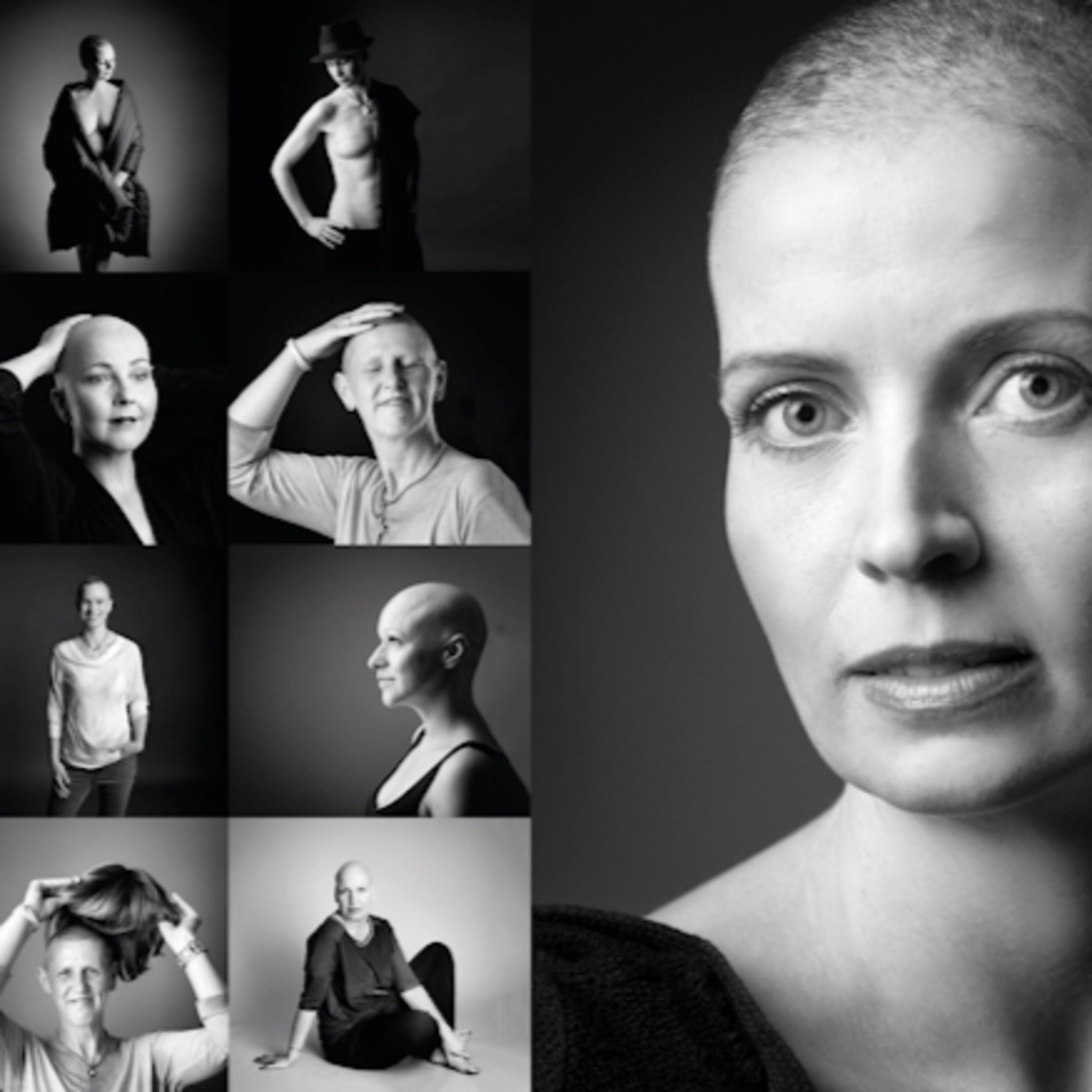 ⓦ 397 Beate Knappe zum Pink Oktober: Der Angst die Haare vom Kopf fressen - Stärke und Schönheit trotz Krebserkrankung