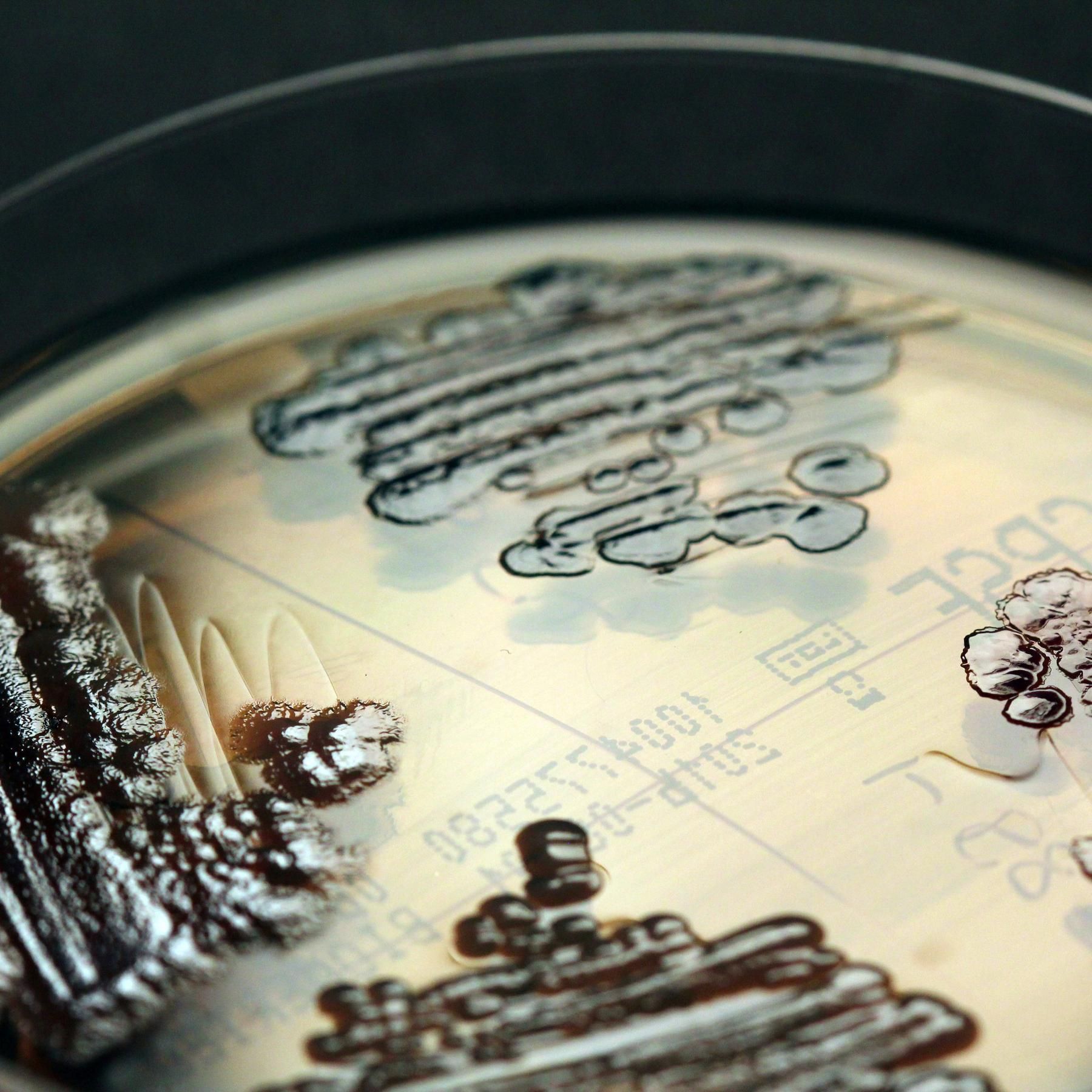 Antibiotikaresistenzen, Russlands Cyberattacken, Soziale Ungleichheit und Corona