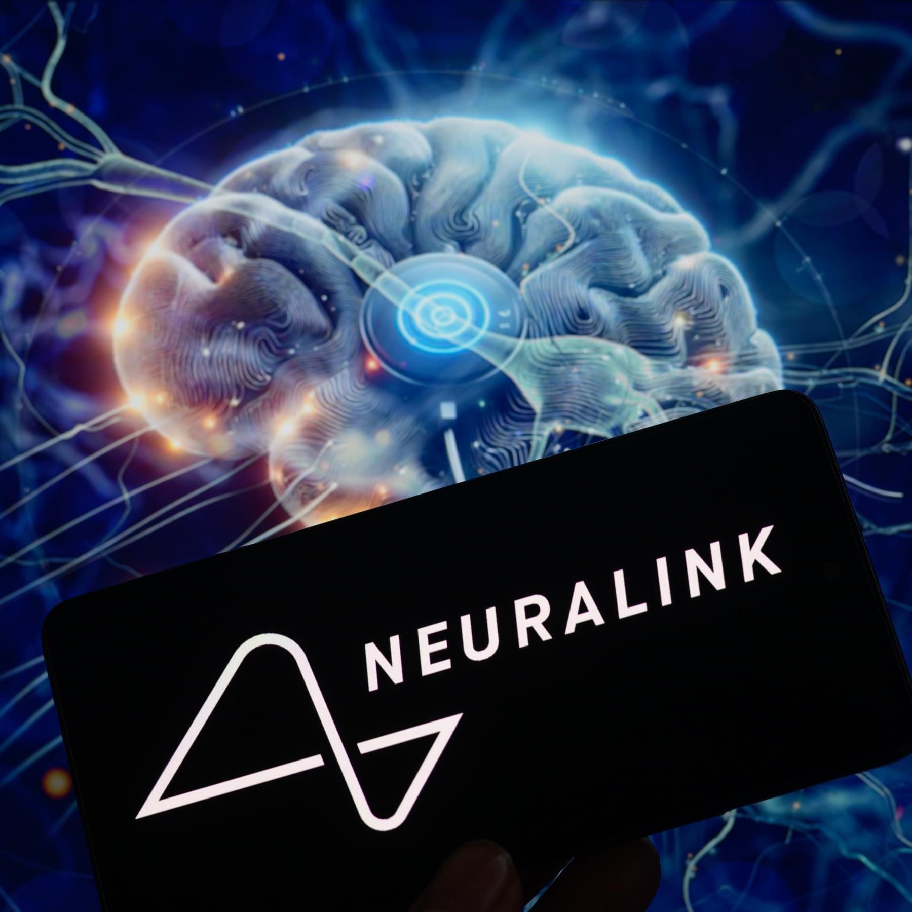 Erstes Hirnimplantat durch Neuralink, Sternenhimmel im Februar