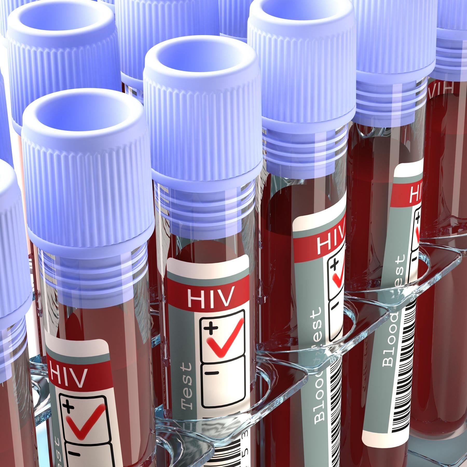 HIV-Heilung dank Stammzellentransplantation, Kommunikation unter Bäumen, Kuschelhormon Oxytocin