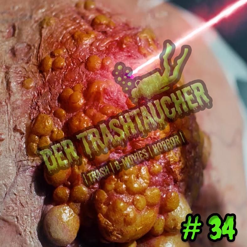 #034 - CYST (2020)