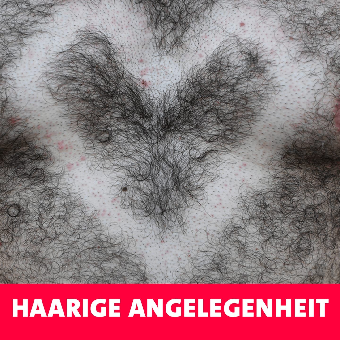 Haarige Angelegenheit – Kopf, Gesicht, Rücken, Brust, Scham, Po, Beine